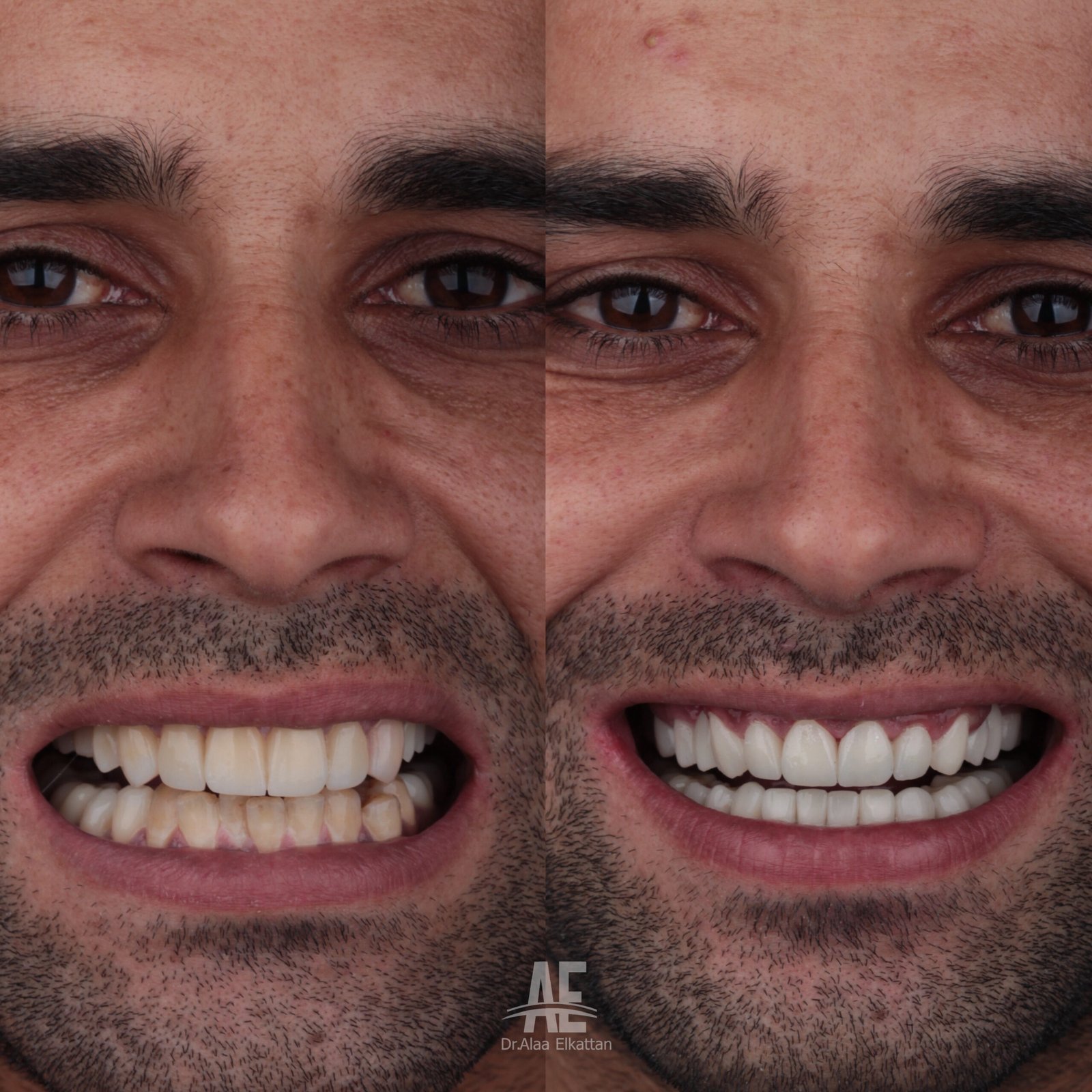 حالة موثقة 7 - Royal Dental Center