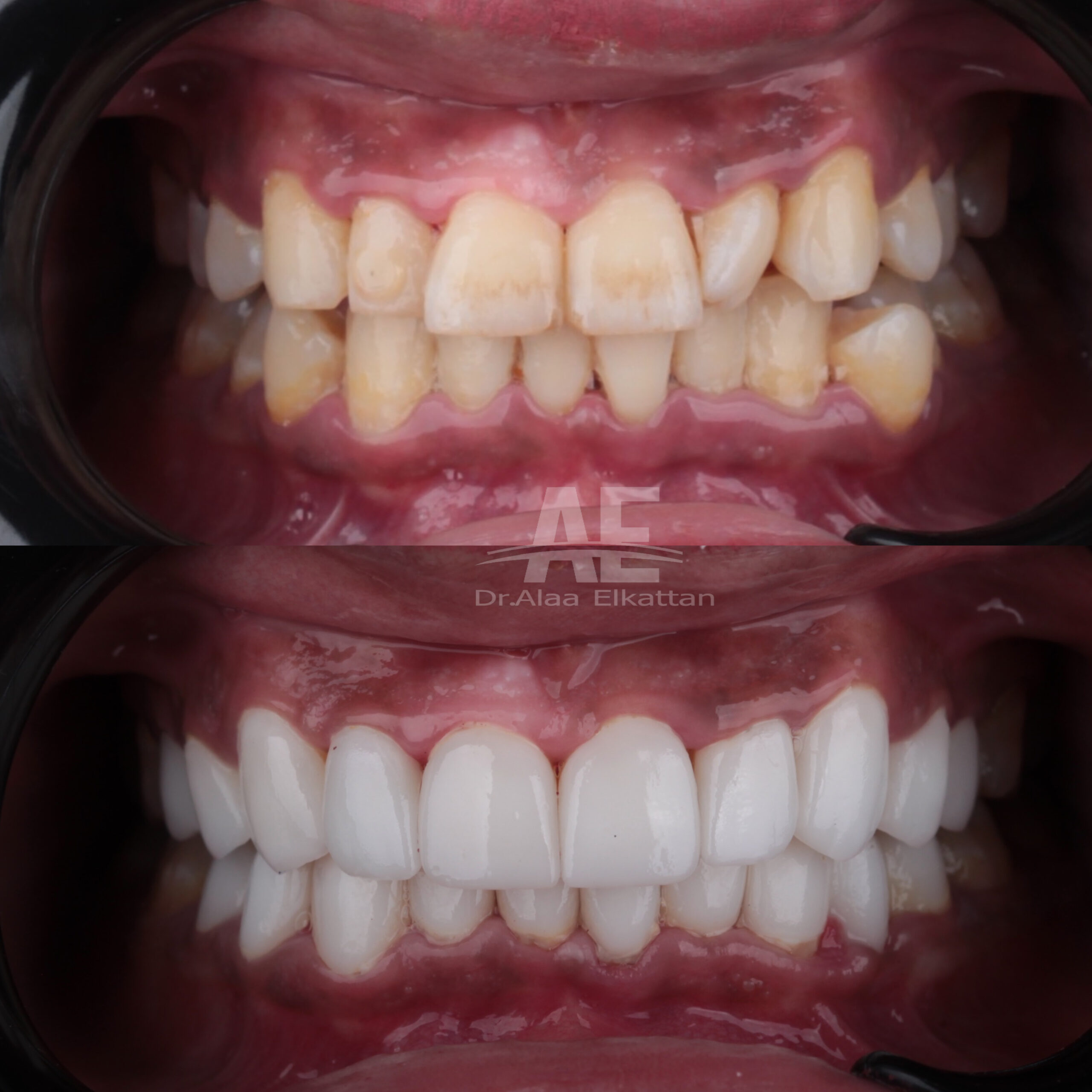 حالة موثقة 18 - Royal Dental Center