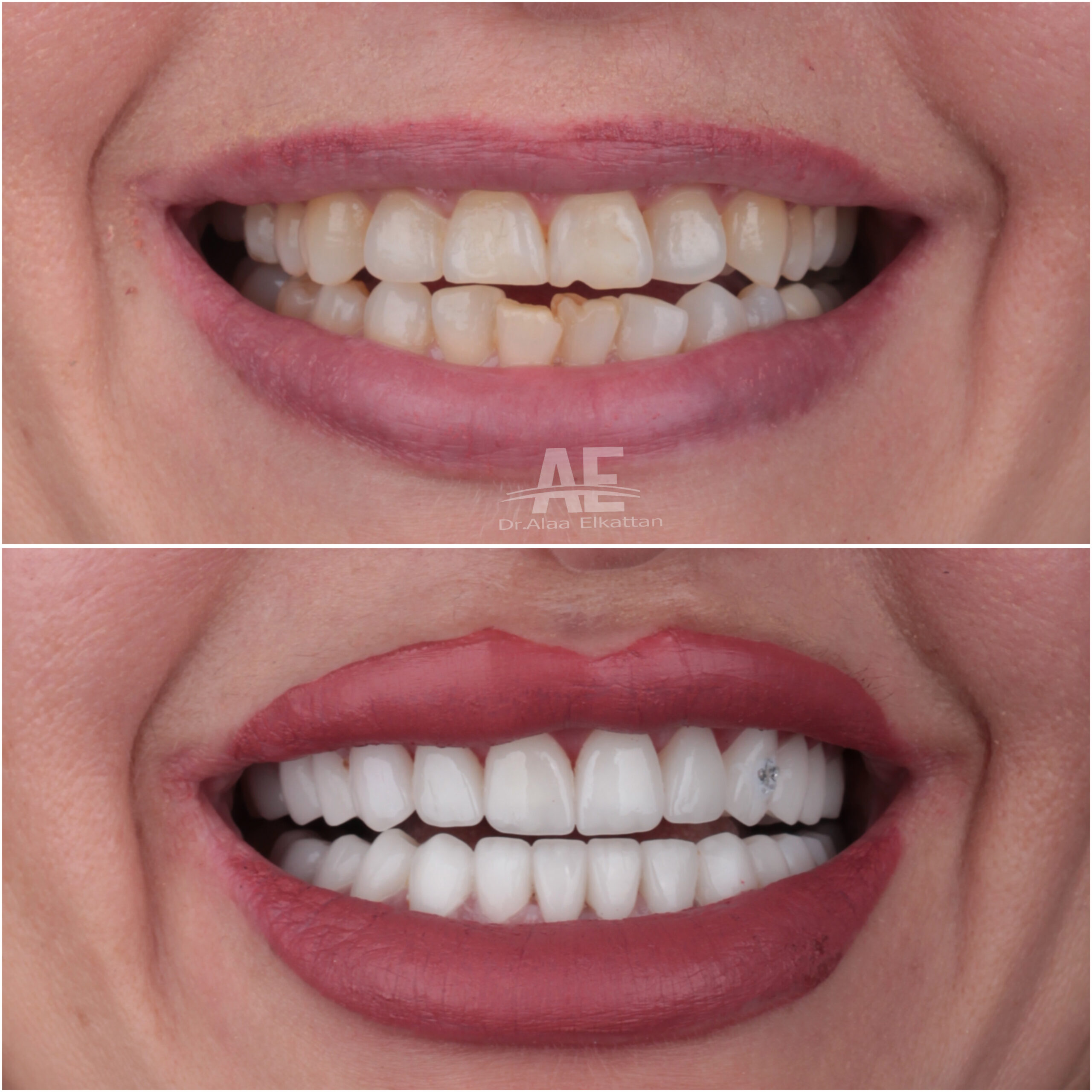 حالة موثقة 41 - Royal Dental Center