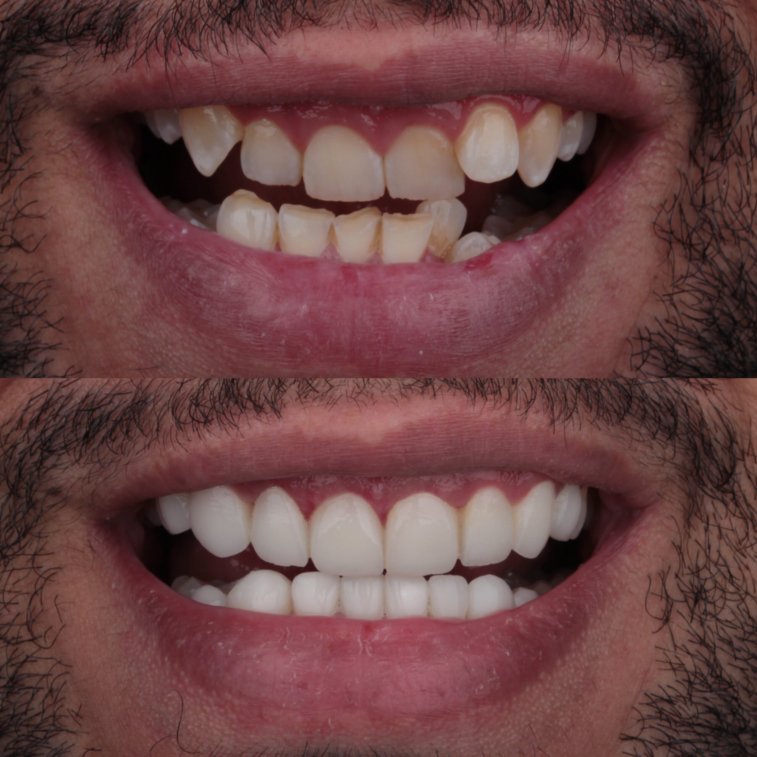 حالة موثقة 63 - Royal Dental Center