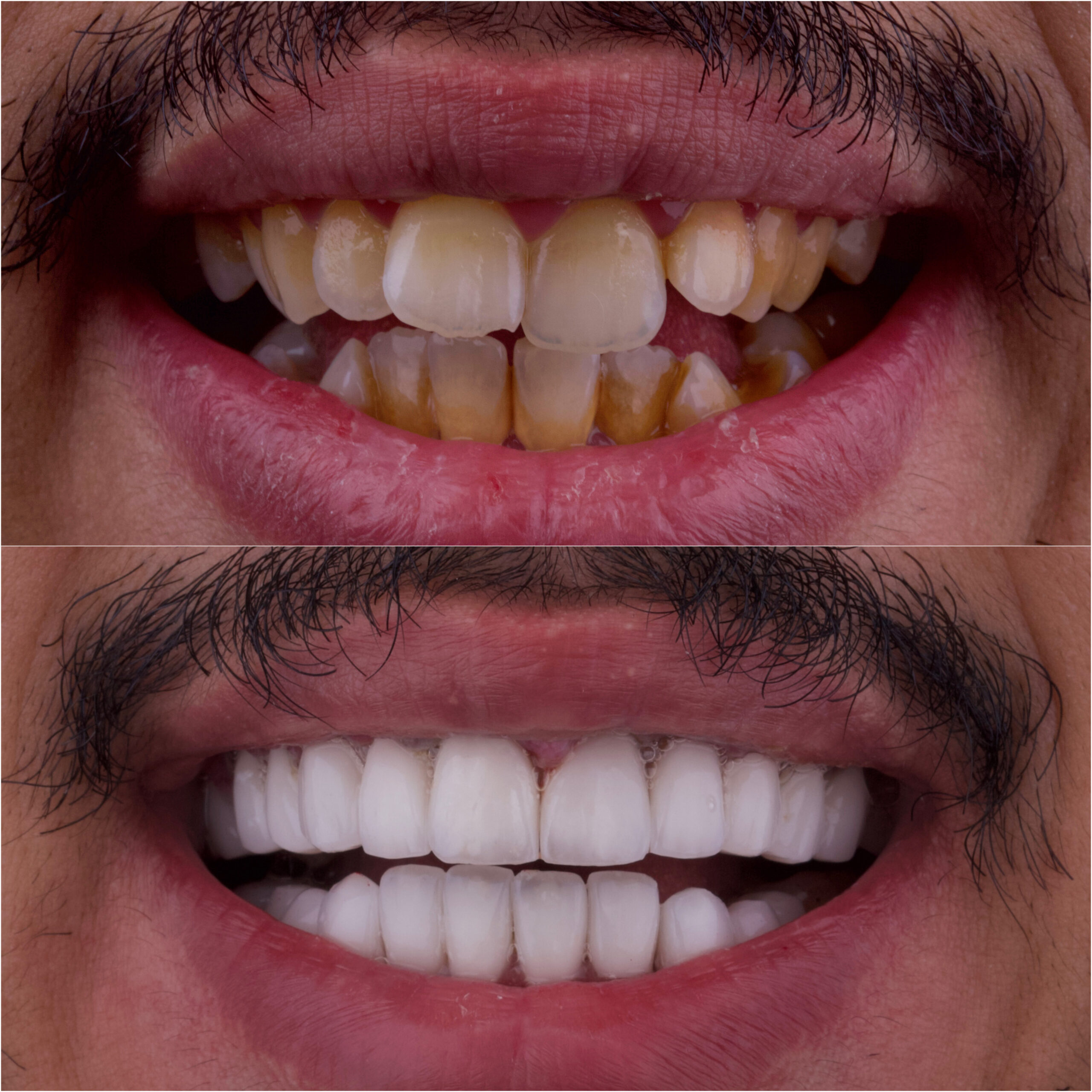 حالة موثقة 69 - Royal Dental Center