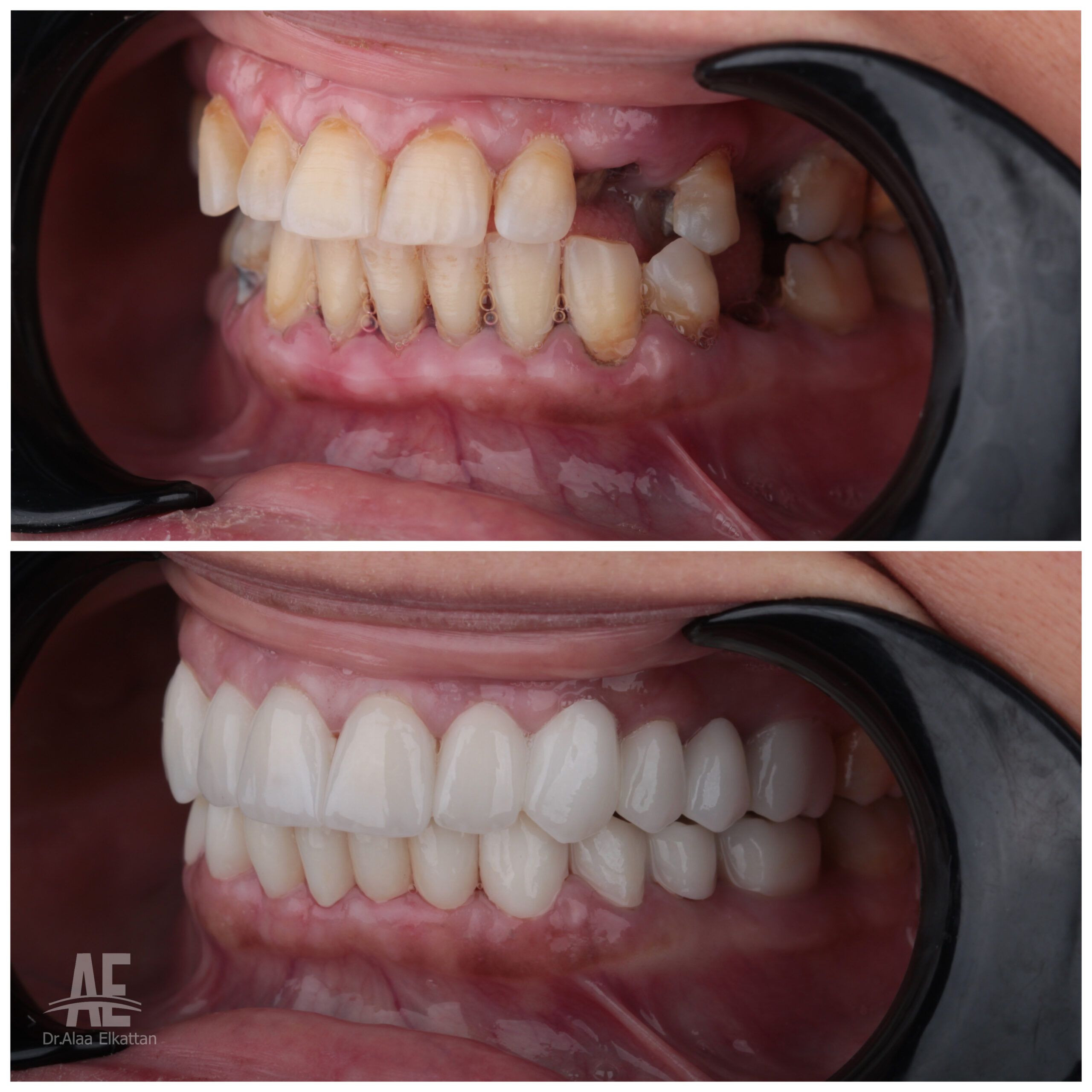 حالة موثقة 32 - Royal Dental Center