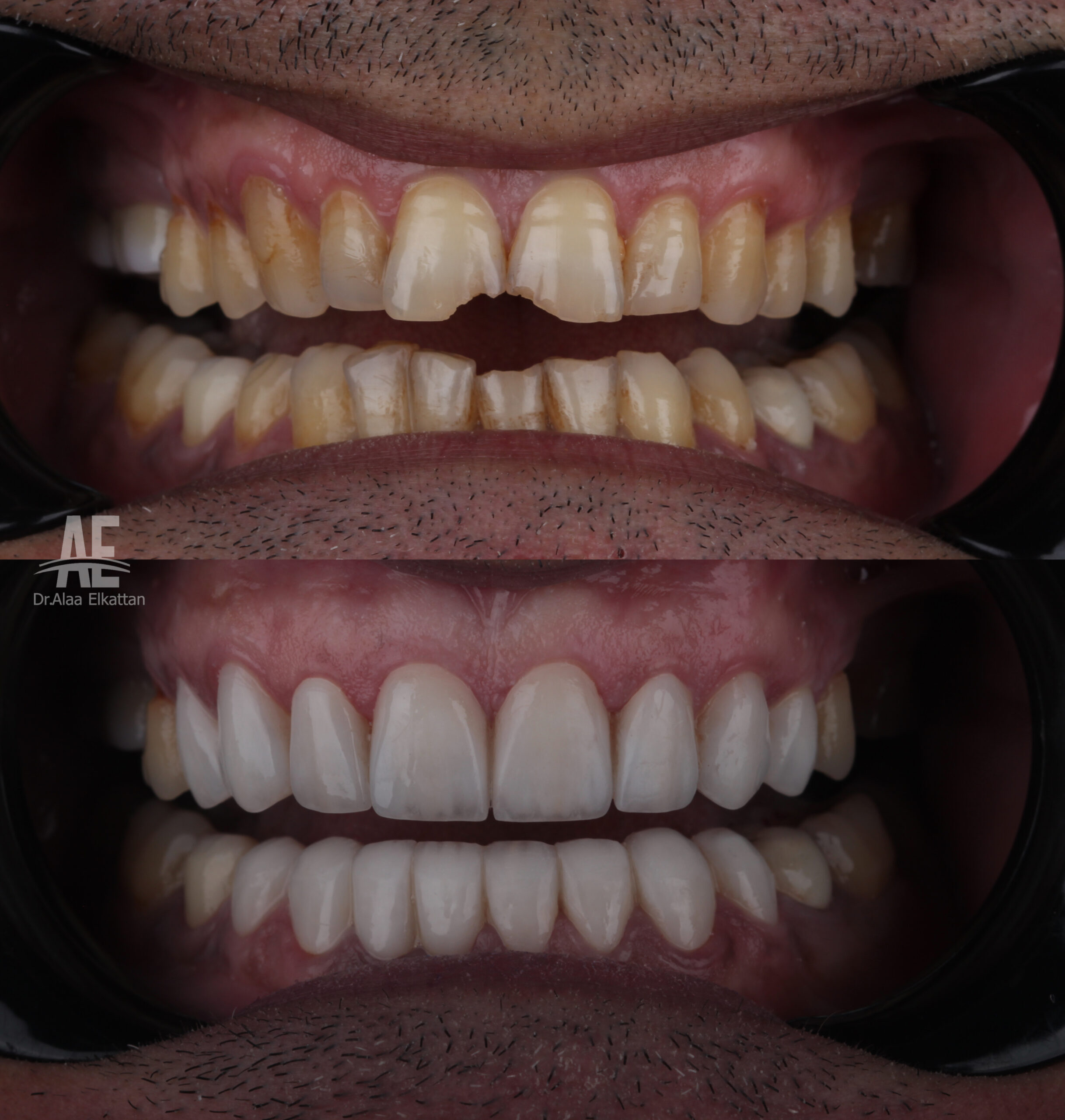 حالة موثقة 39 - Royal Dental Center