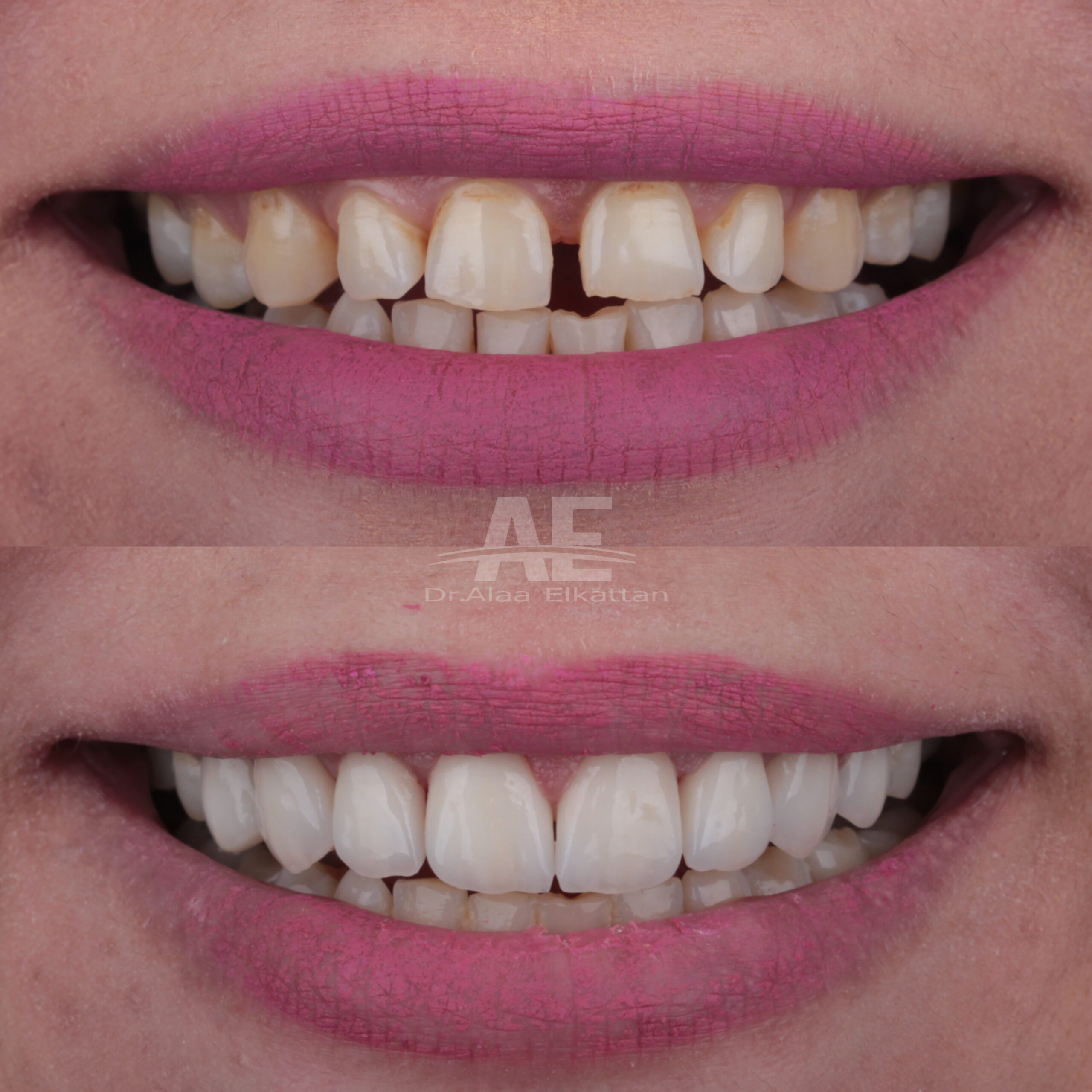 حالة موثقة 53 - Royal Dental Center
