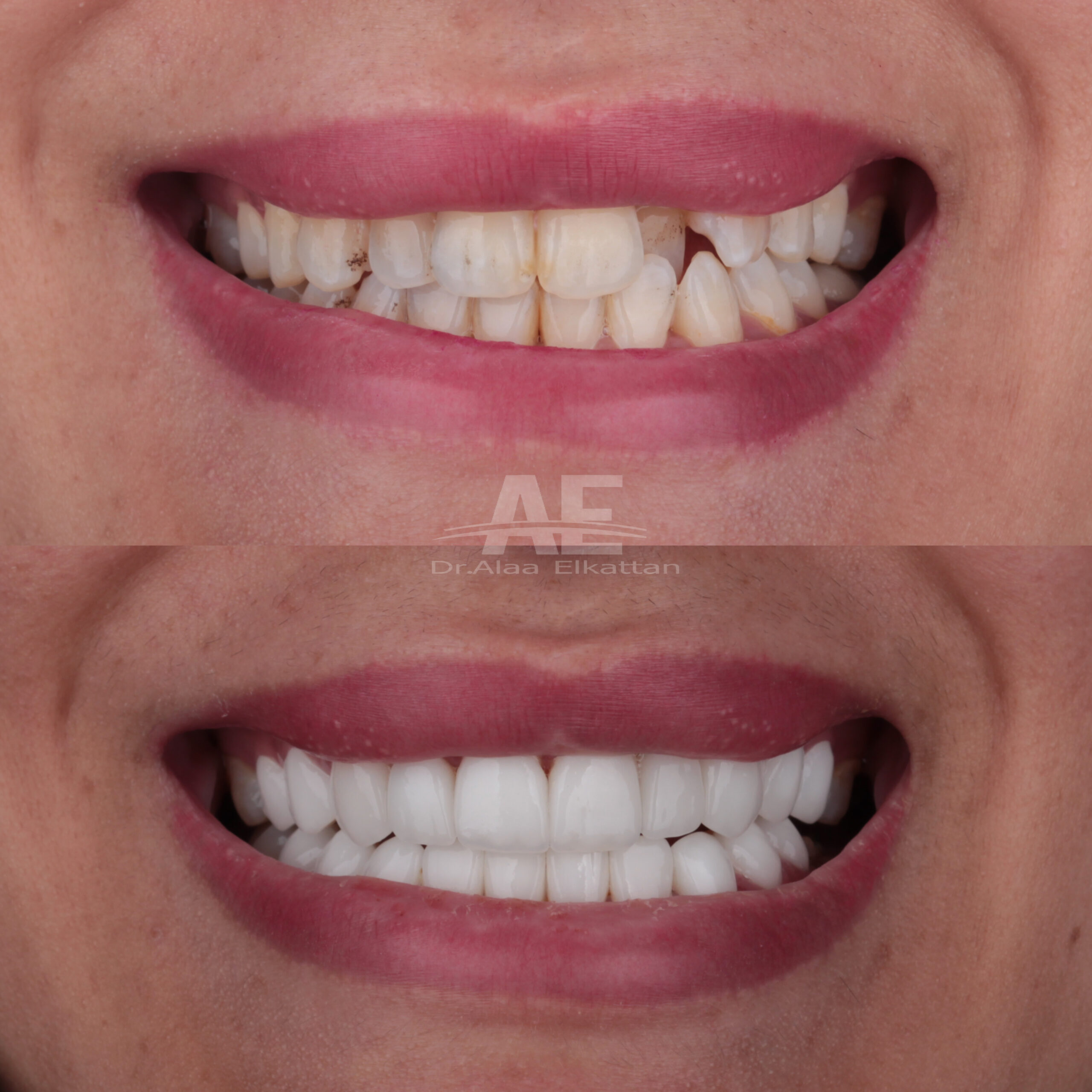 حالة موثقة 49 - Royal Dental Center