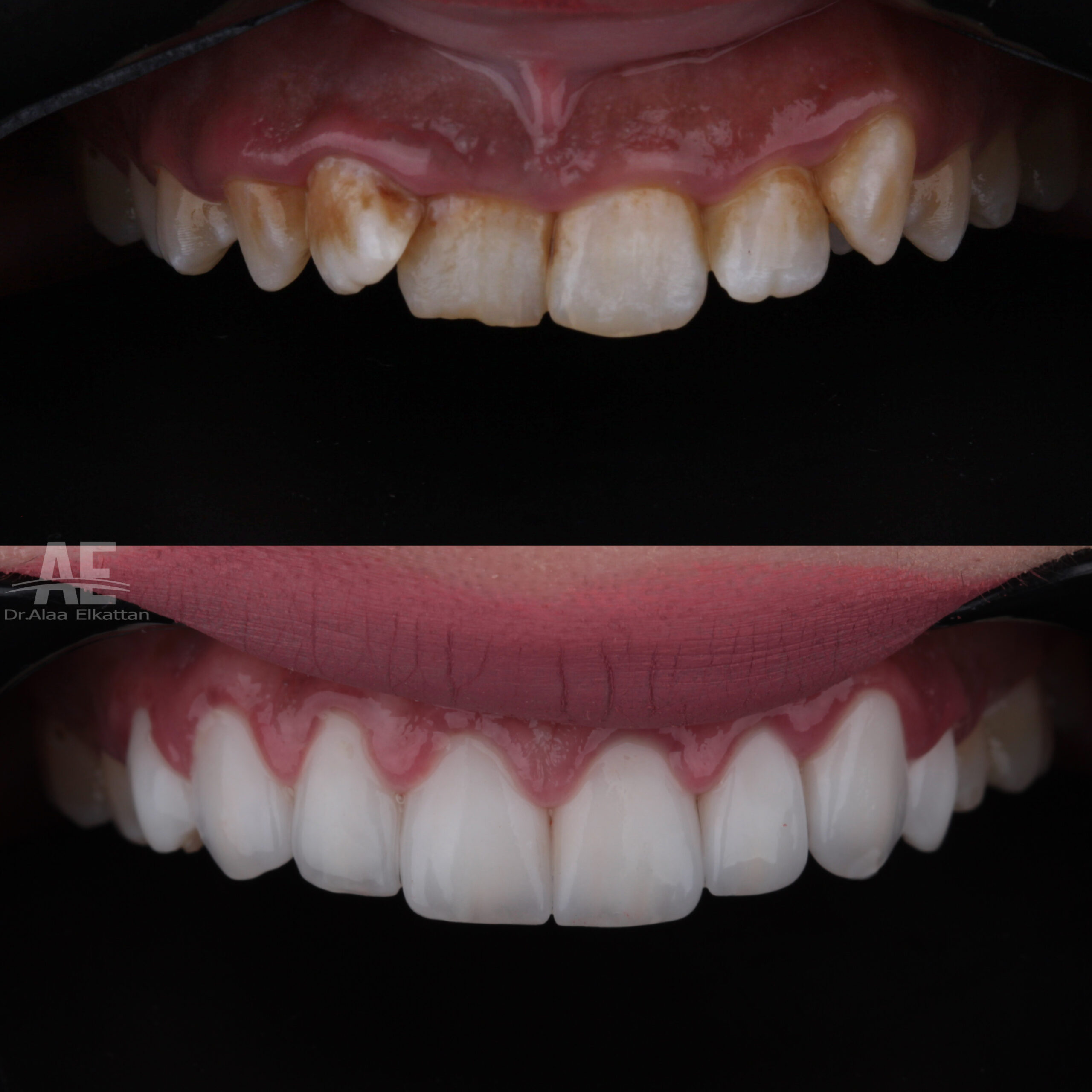 حالة موثقة 22 - Royal Dental Center