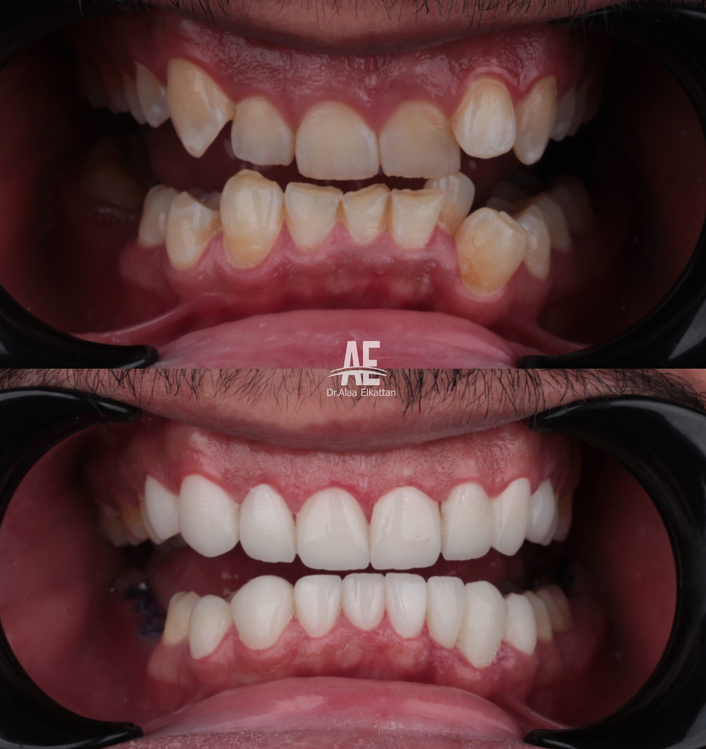حالة موثقة 21 - Royal Dental Center
