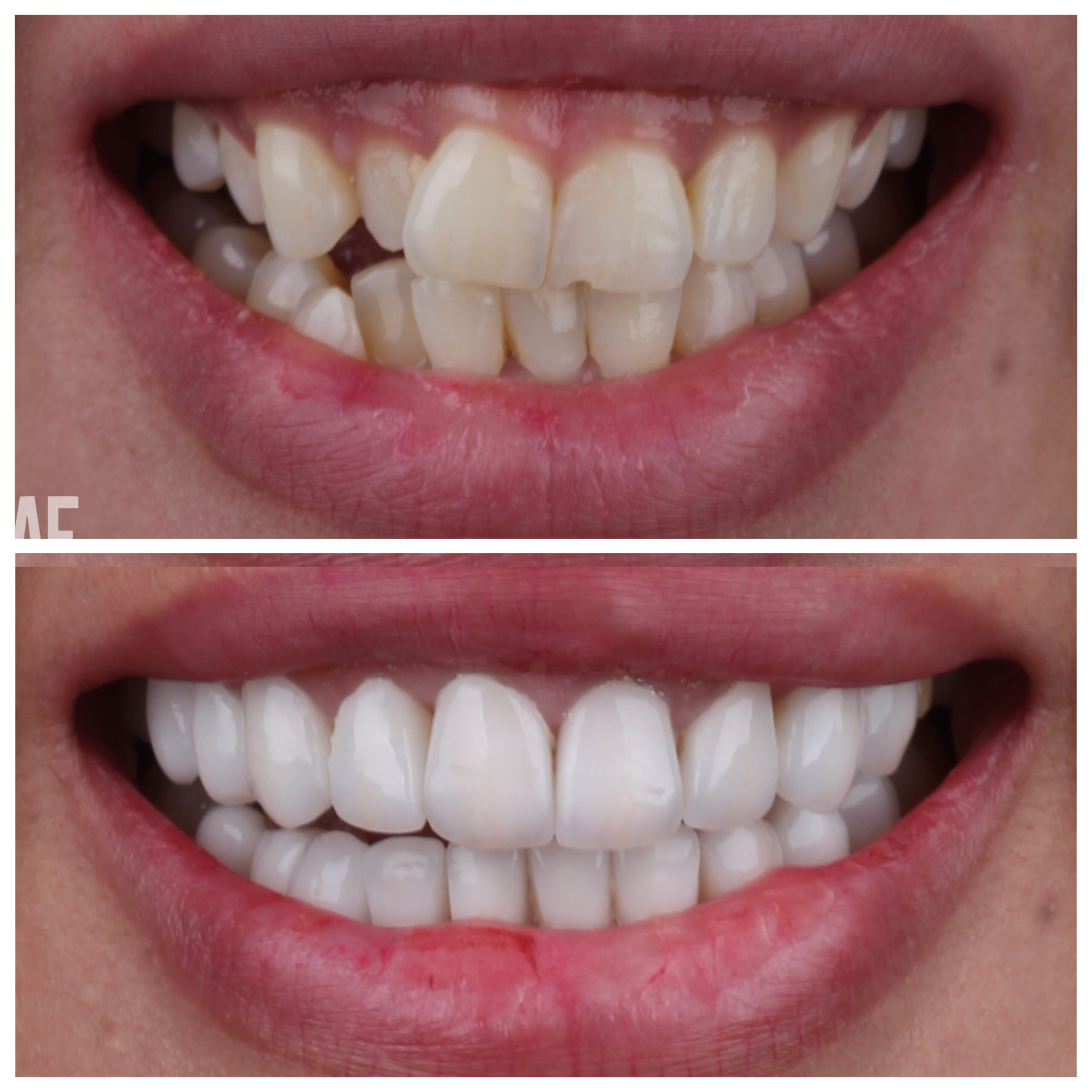 حالة موثقة 28 - Royal Dental Center