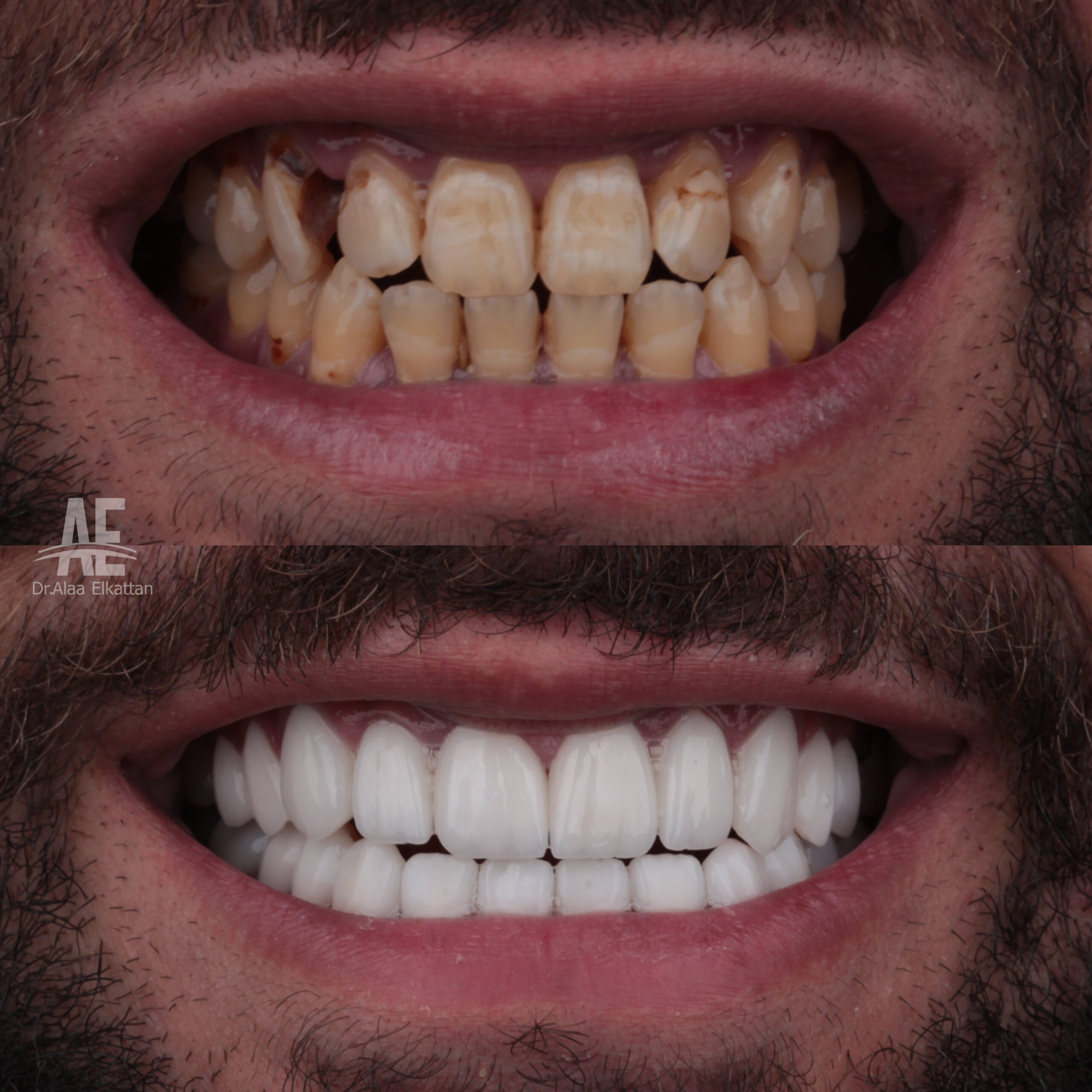 حالة موثقة 54 - Royal Dental Center