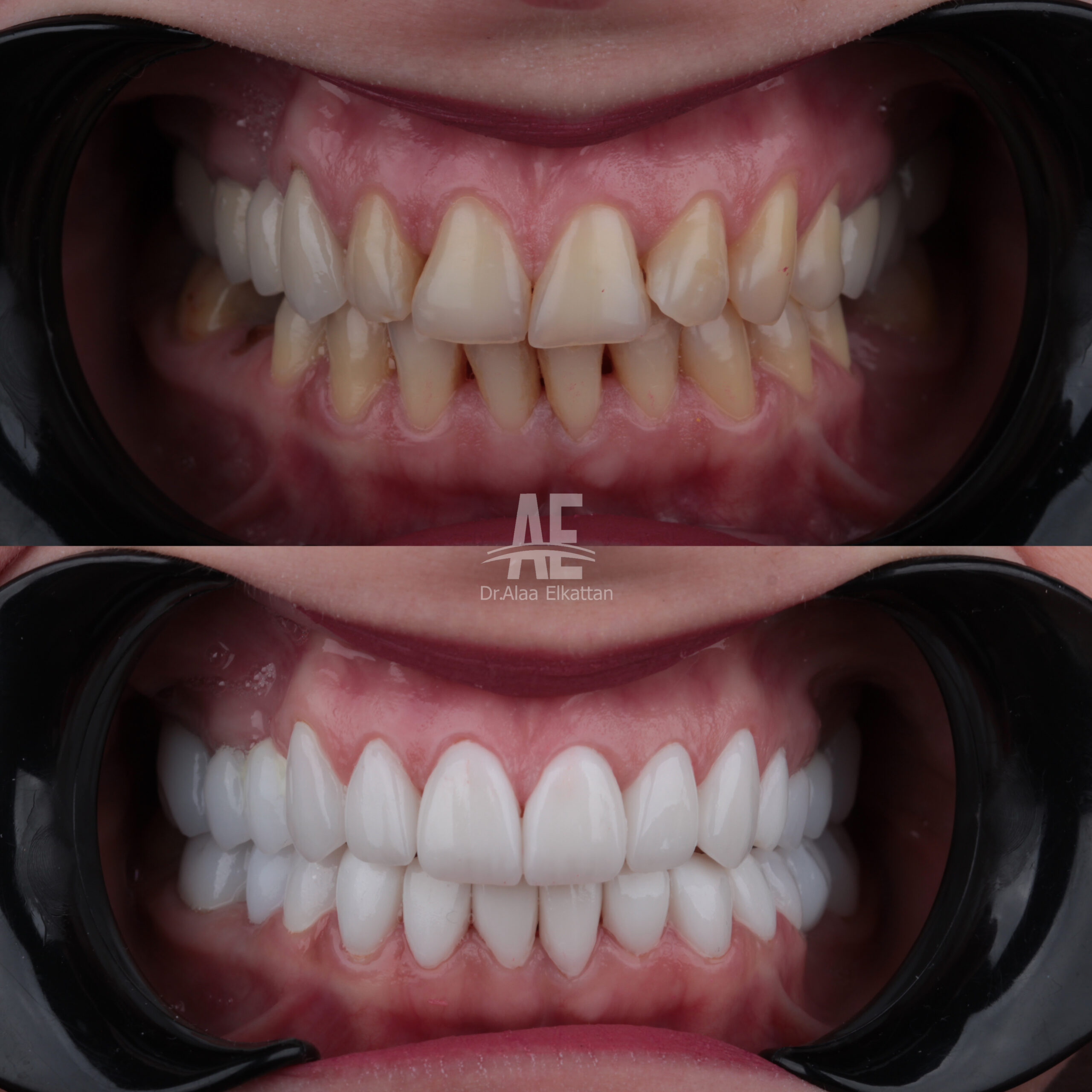 حالة موثقة 29 - Royal Dental Center