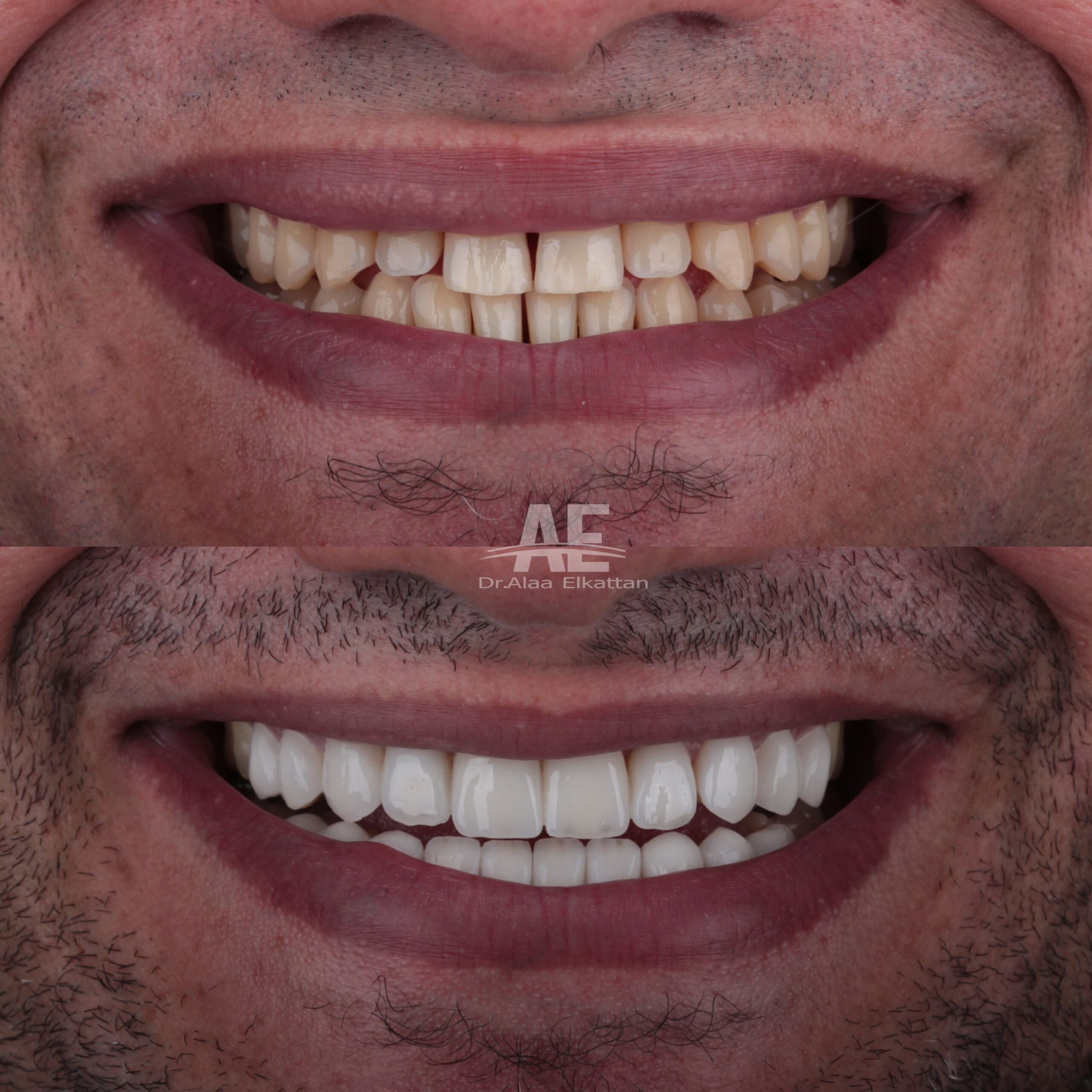 حالة موثقة 65 - Royal Dental Center