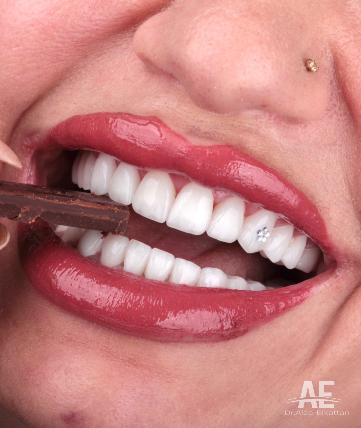 حالة موثقة 22 - Royal Dental Center