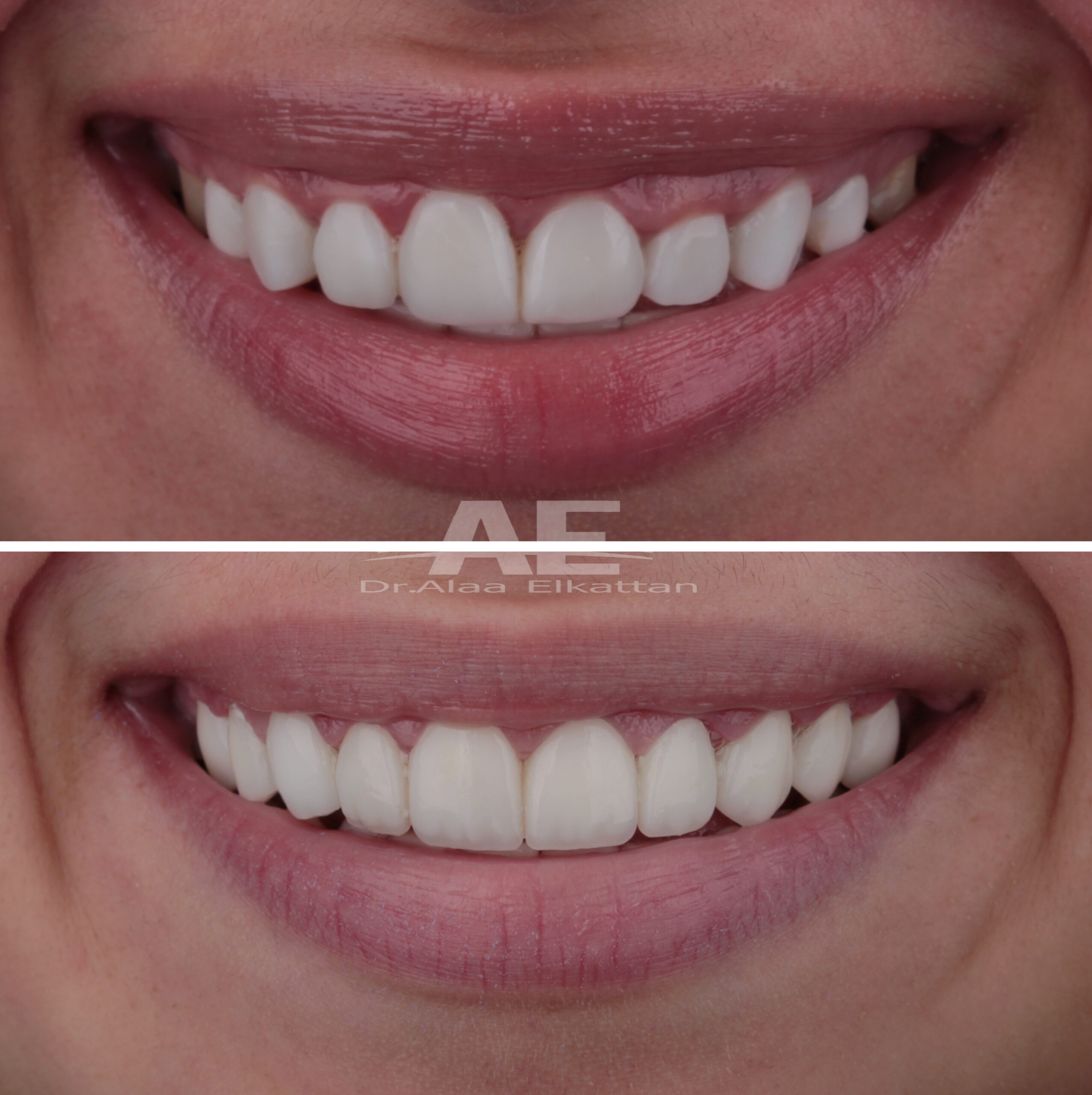 حالة موثقة 33 - Royal Dental Center