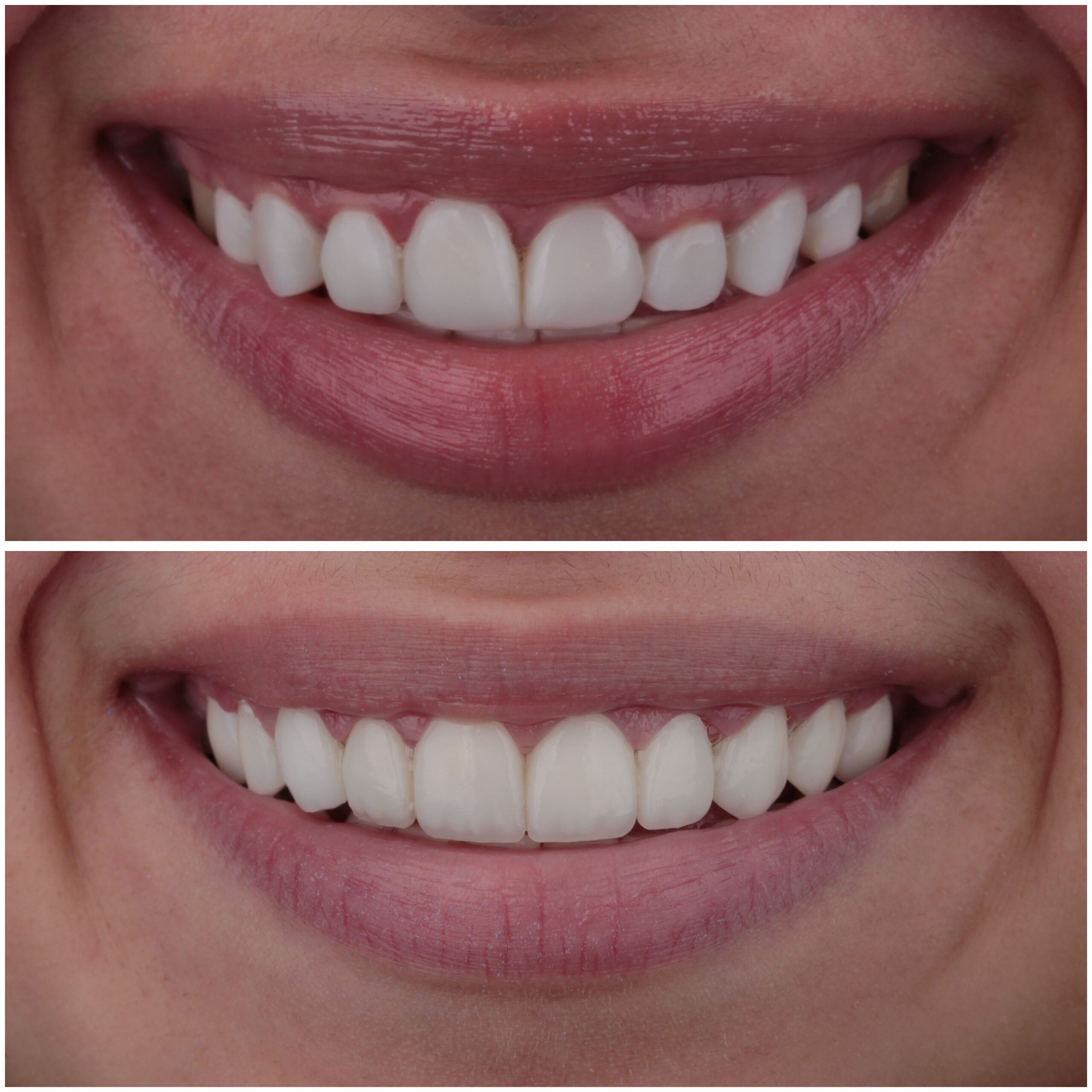 حالة موثقة 42 - Royal Dental Center