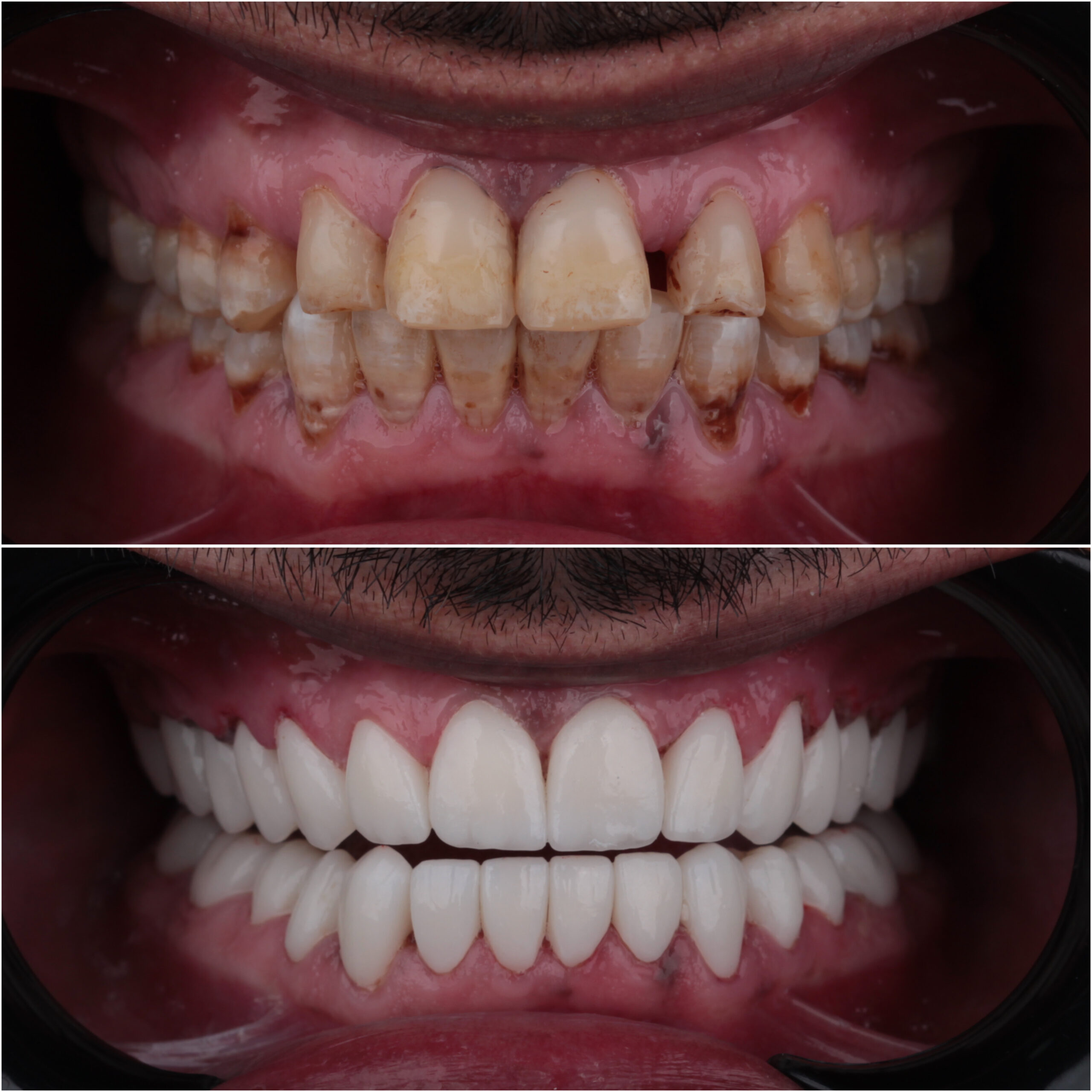 حالة موثقة 34 - Royal Dental Center