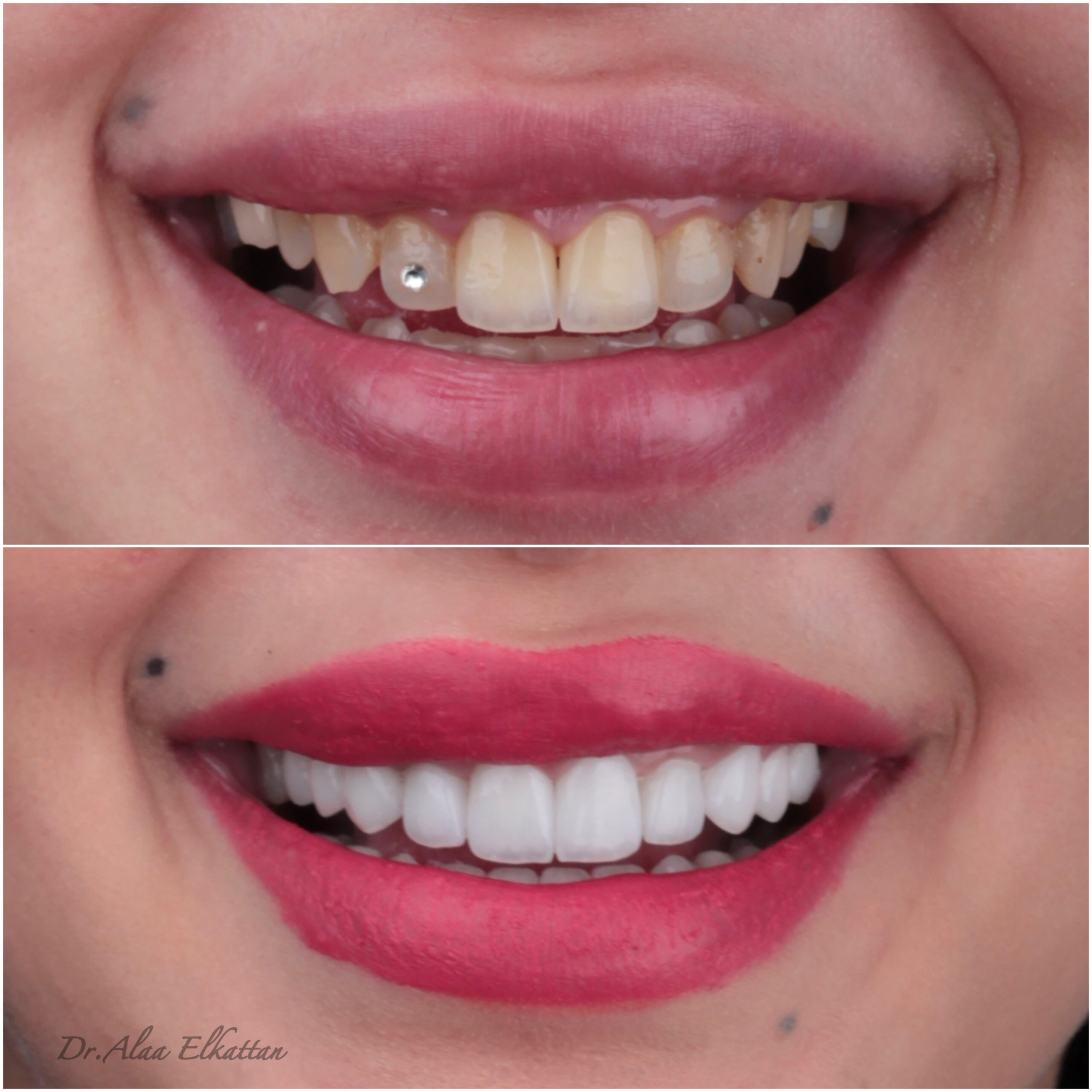 حالة موثقة 23 - Royal Dental Center