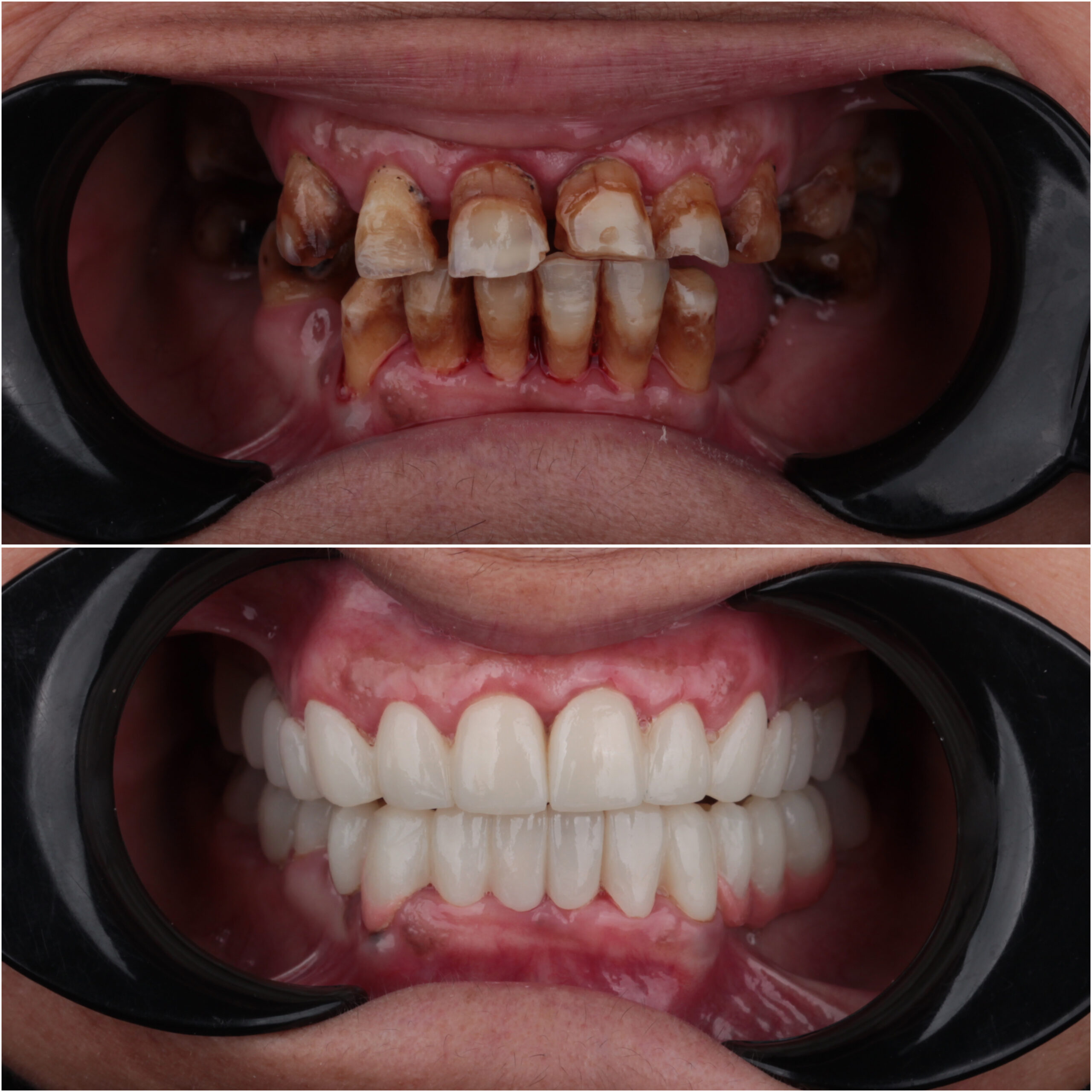حالة موثقة 44 - Royal Dental Center