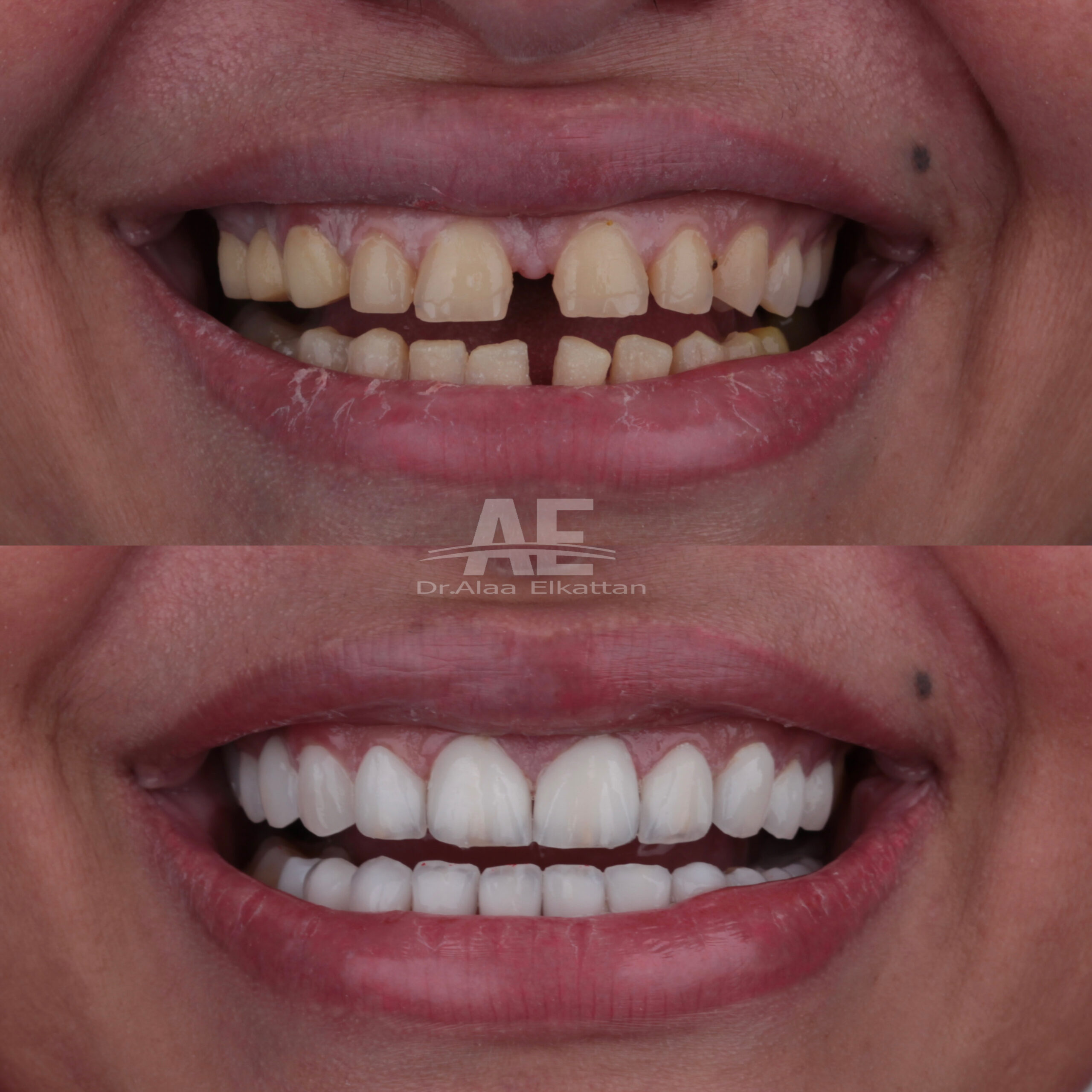 حالة موثقة 45 - Royal Dental Center