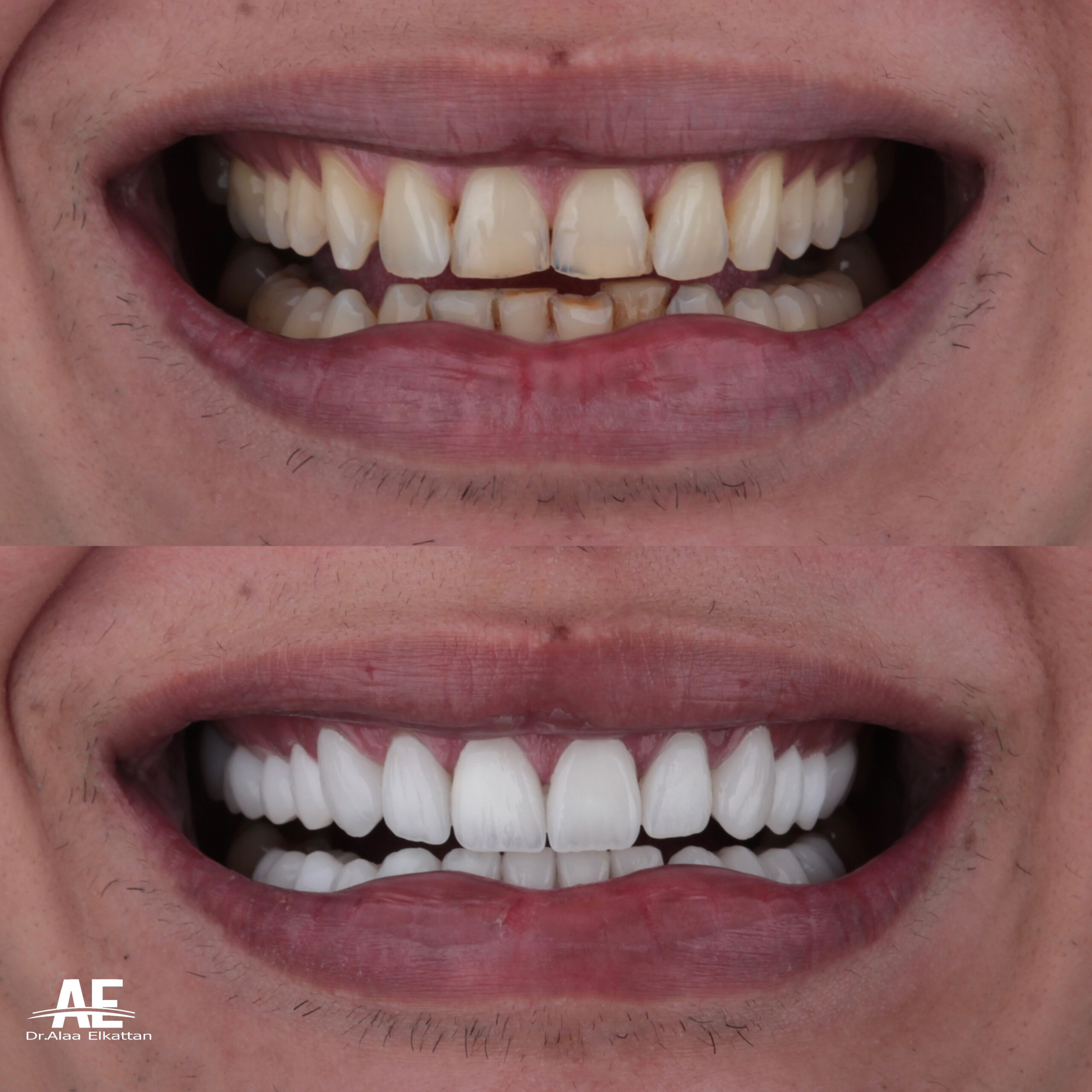 حالة موثقة 47 - Royal Dental Center