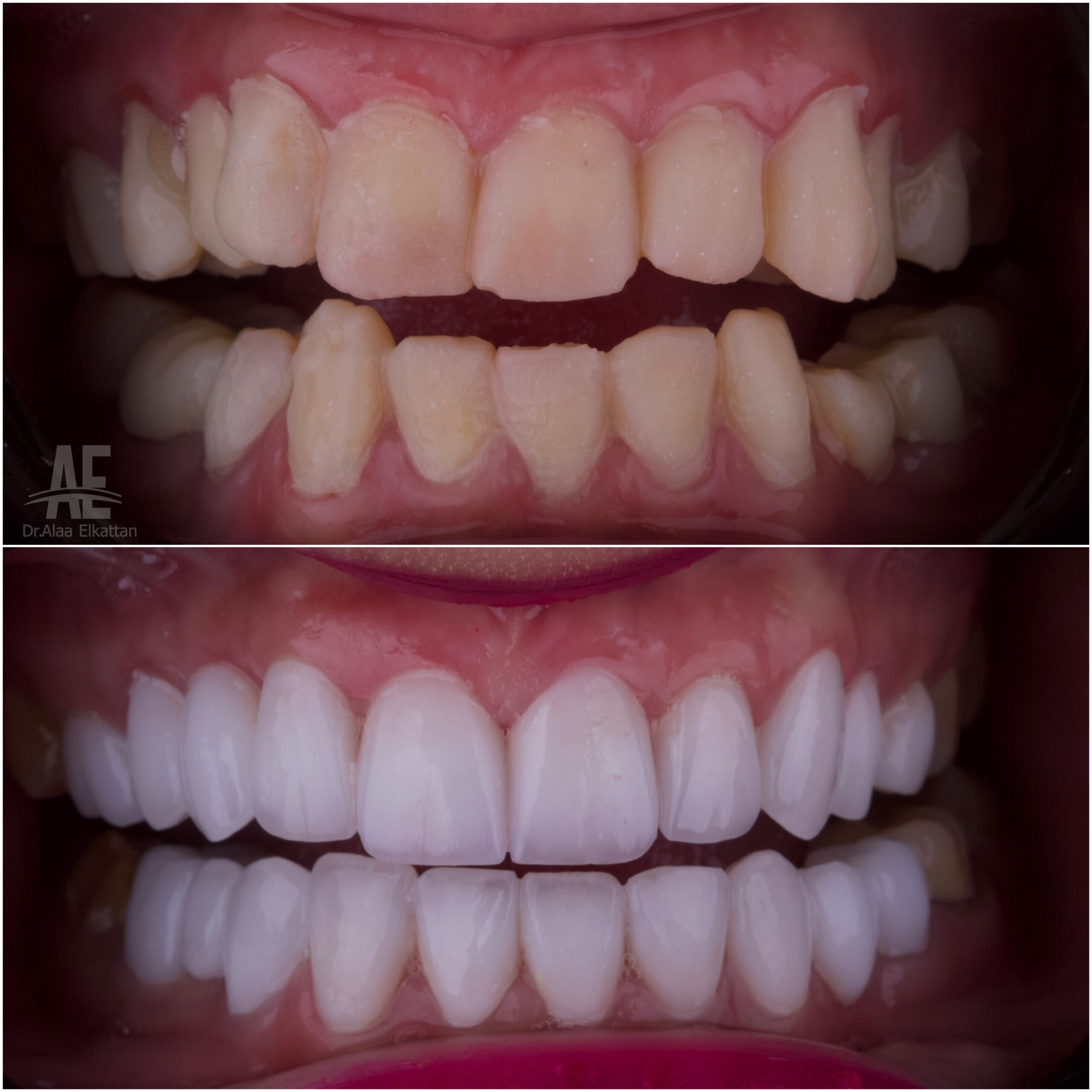 حالة موثقة 48 - Royal Dental Center