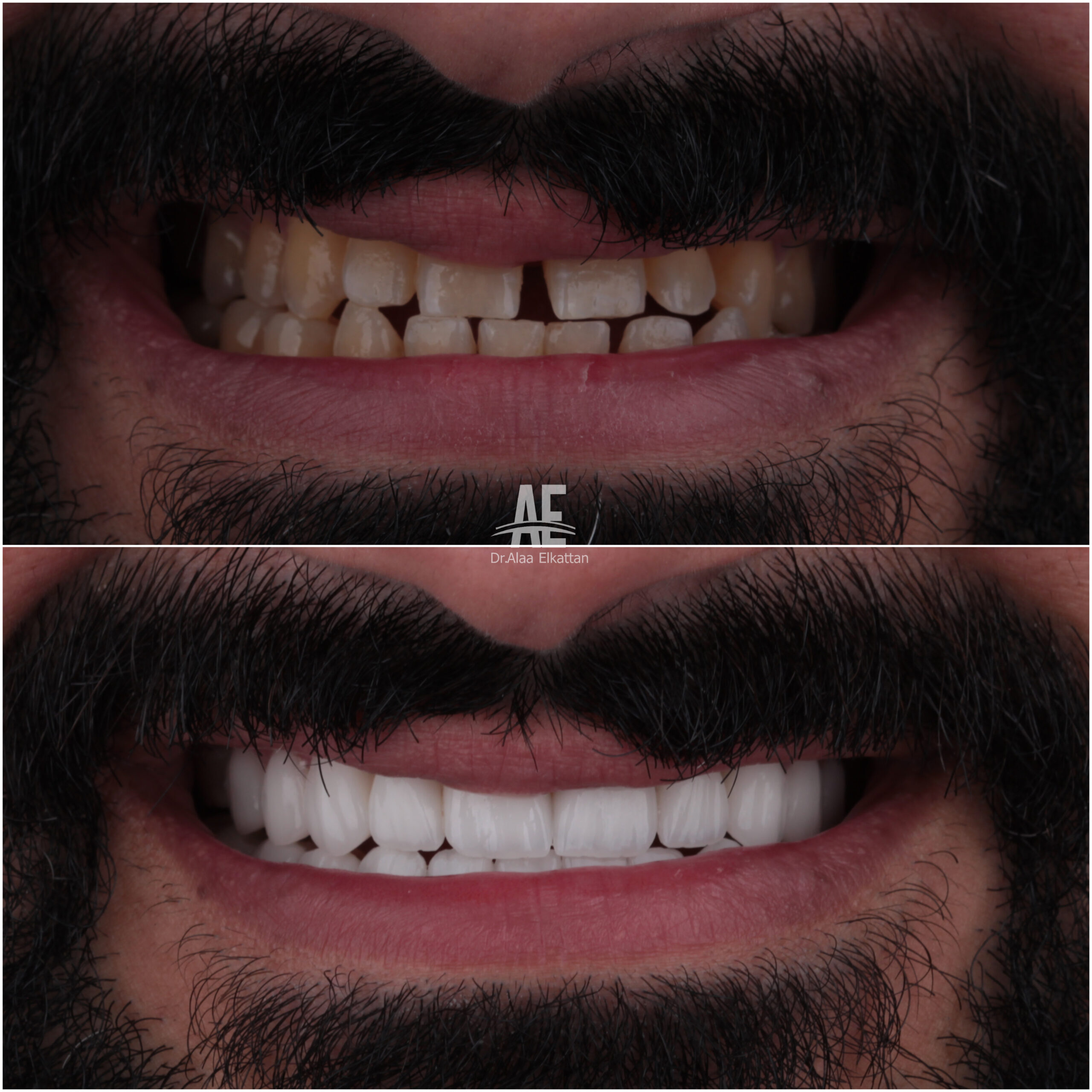 حالة موثقة 61 - Royal Dental Center