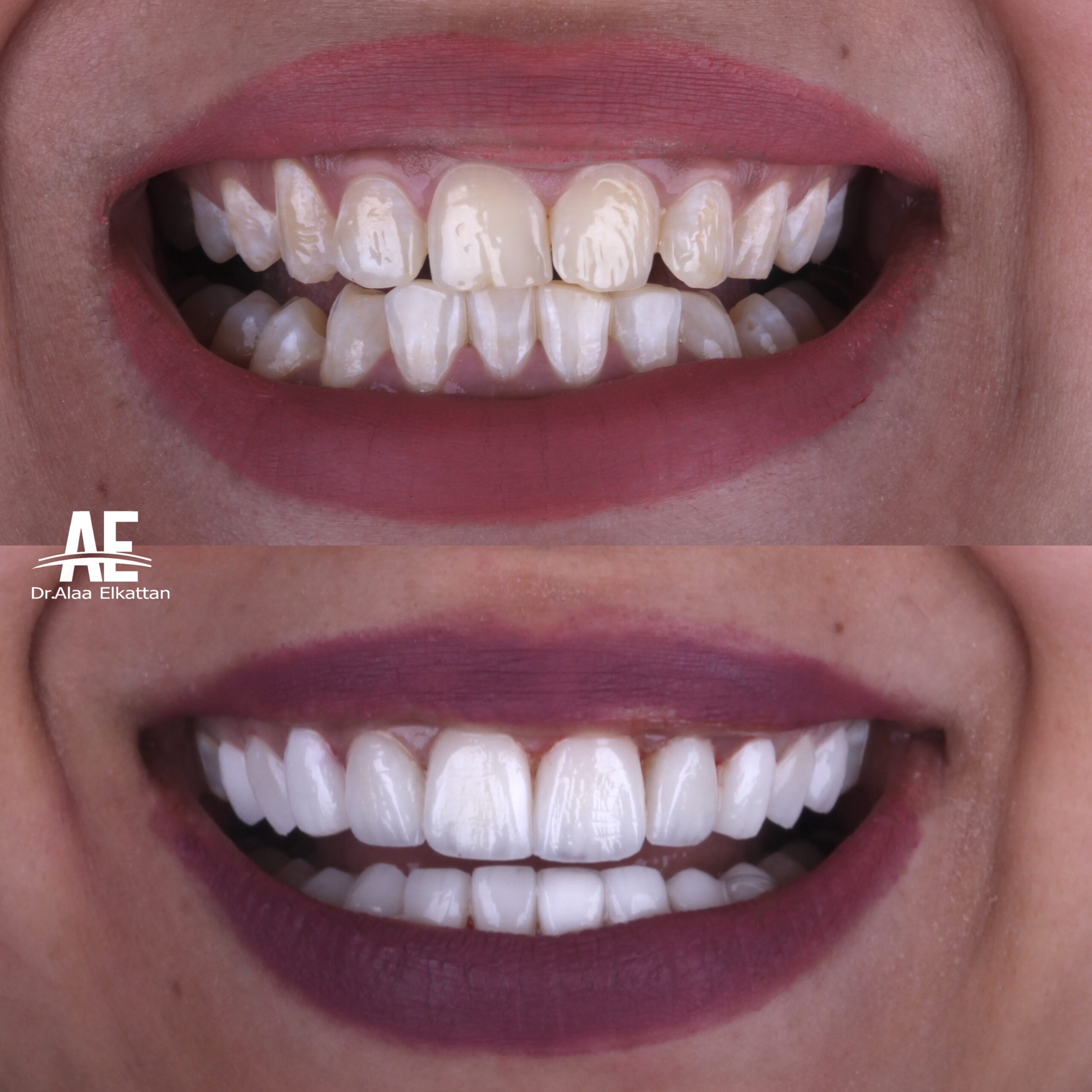 حالة موثقة 38 - Royal Dental Center