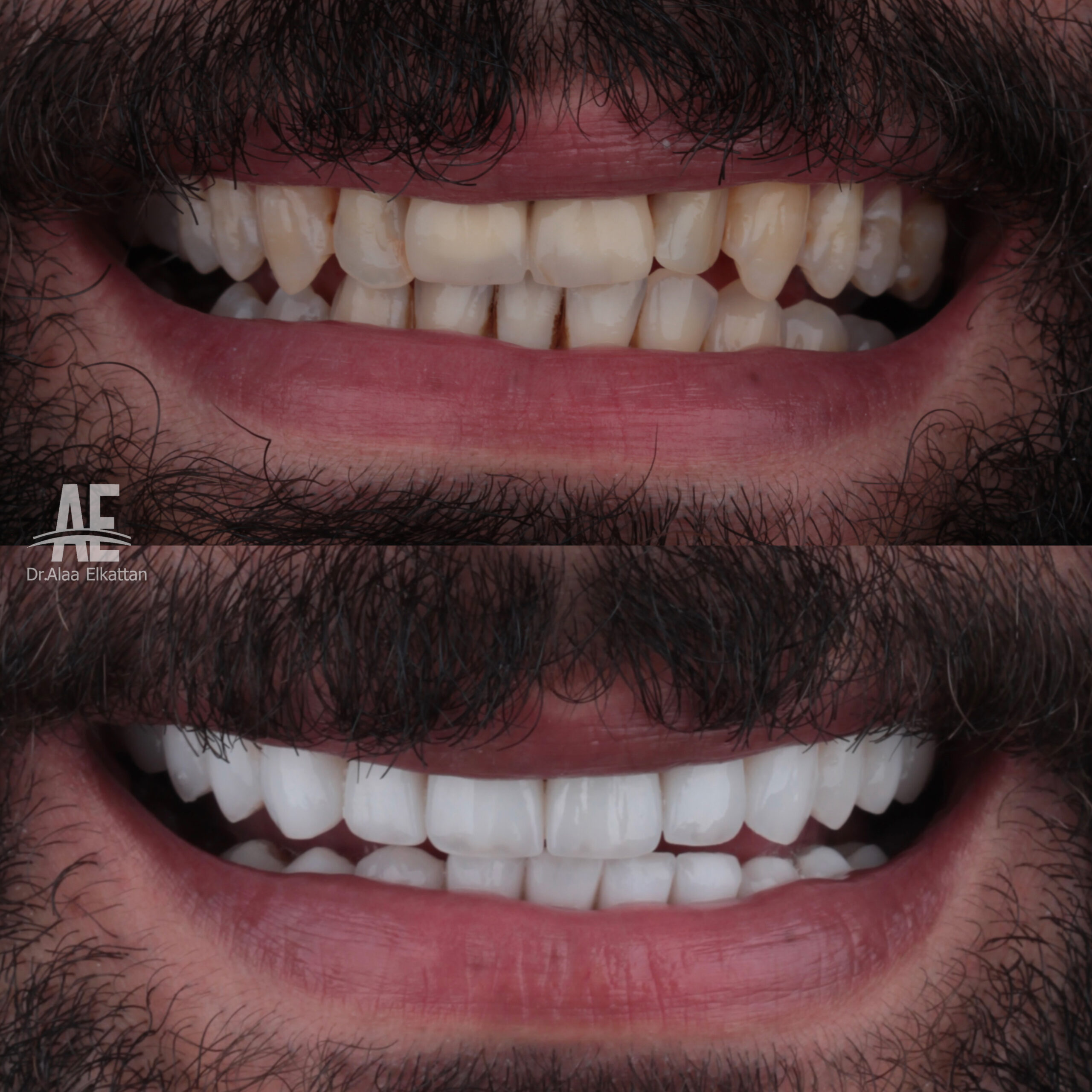حالة موثقة 60 - Royal Dental Center