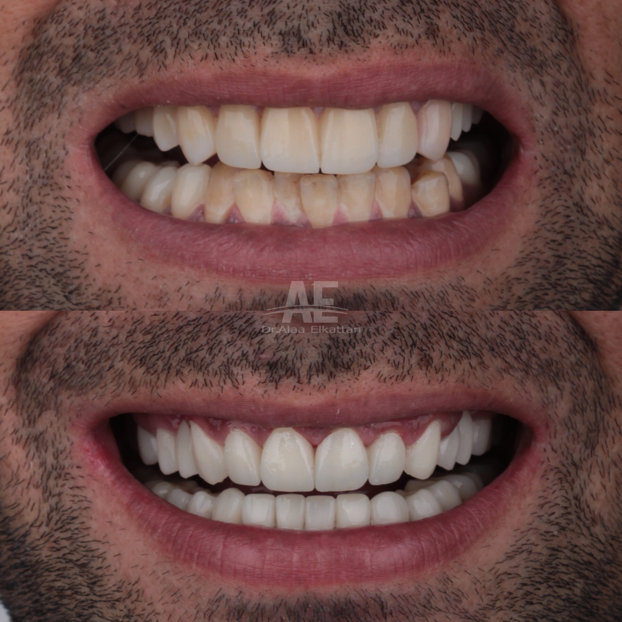 حالة موثقة 59 - Royal Dental Center