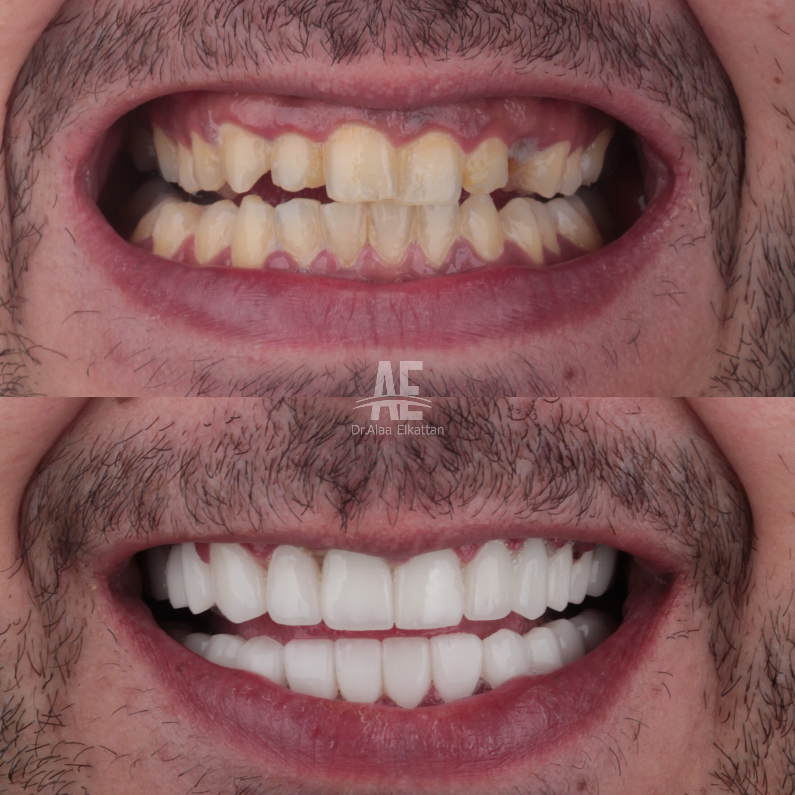 حالة موثقة 58 - Royal Dental Center