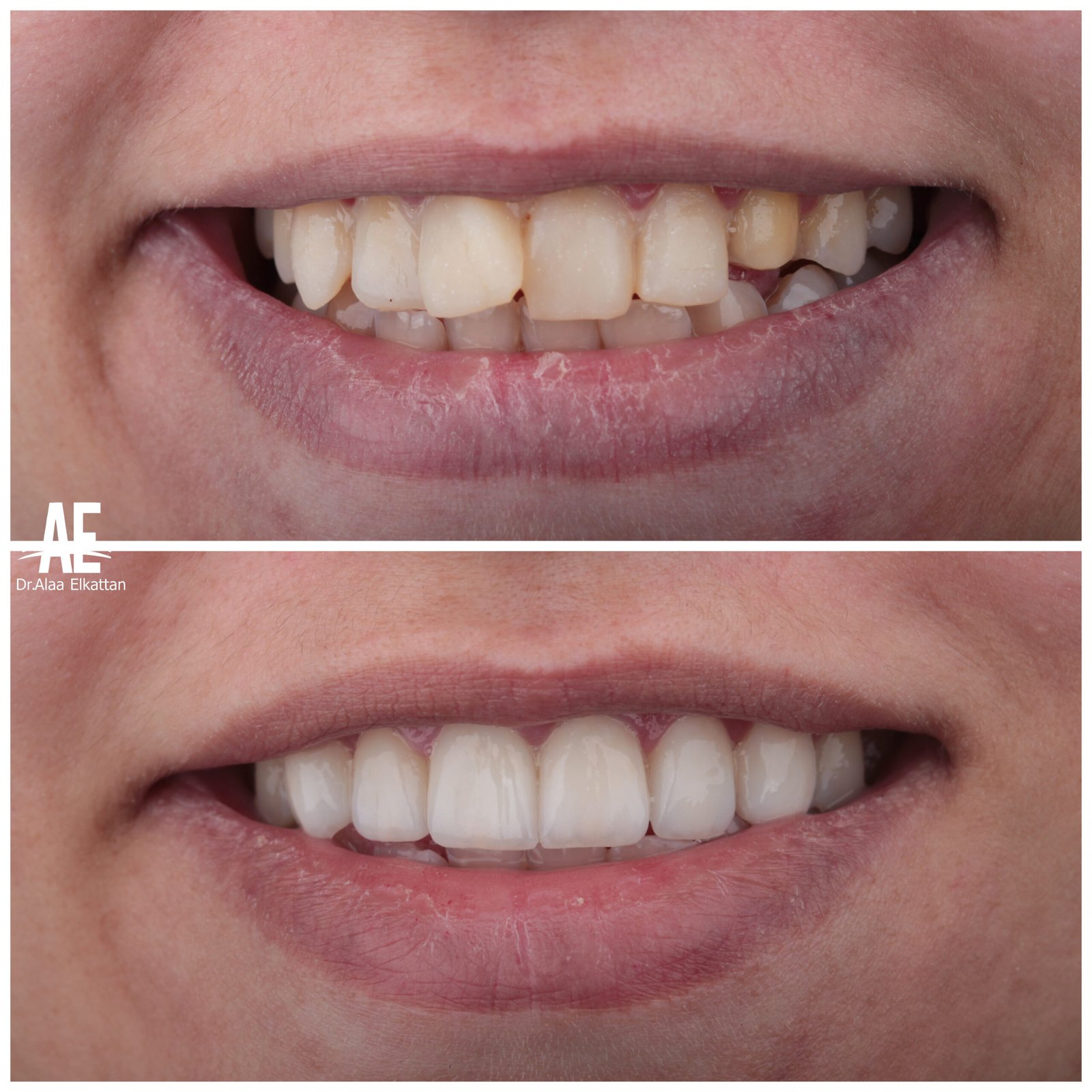 حالة موثقة 8 - Royal Dental Center