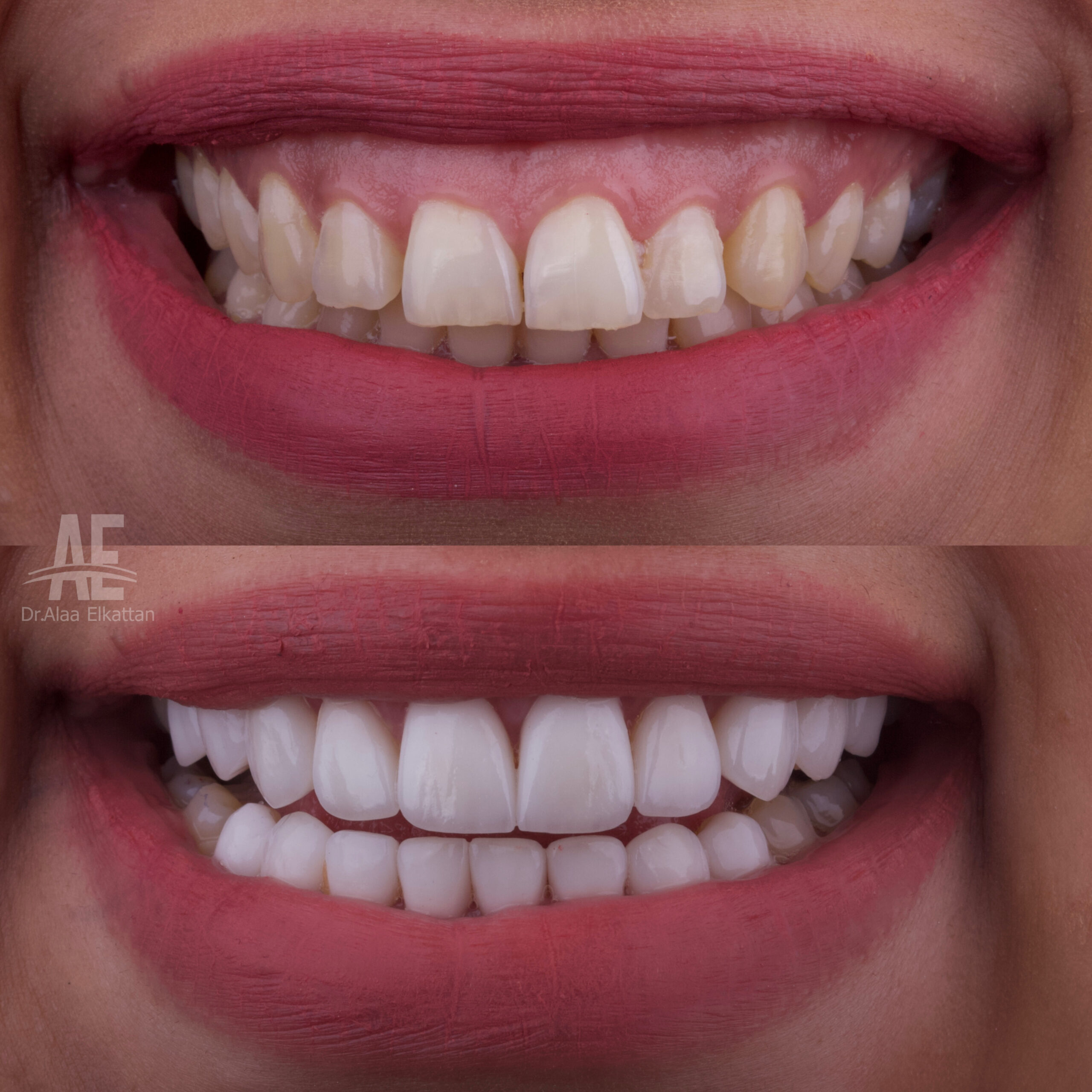 حالة موثقة 66 - Royal Dental Center