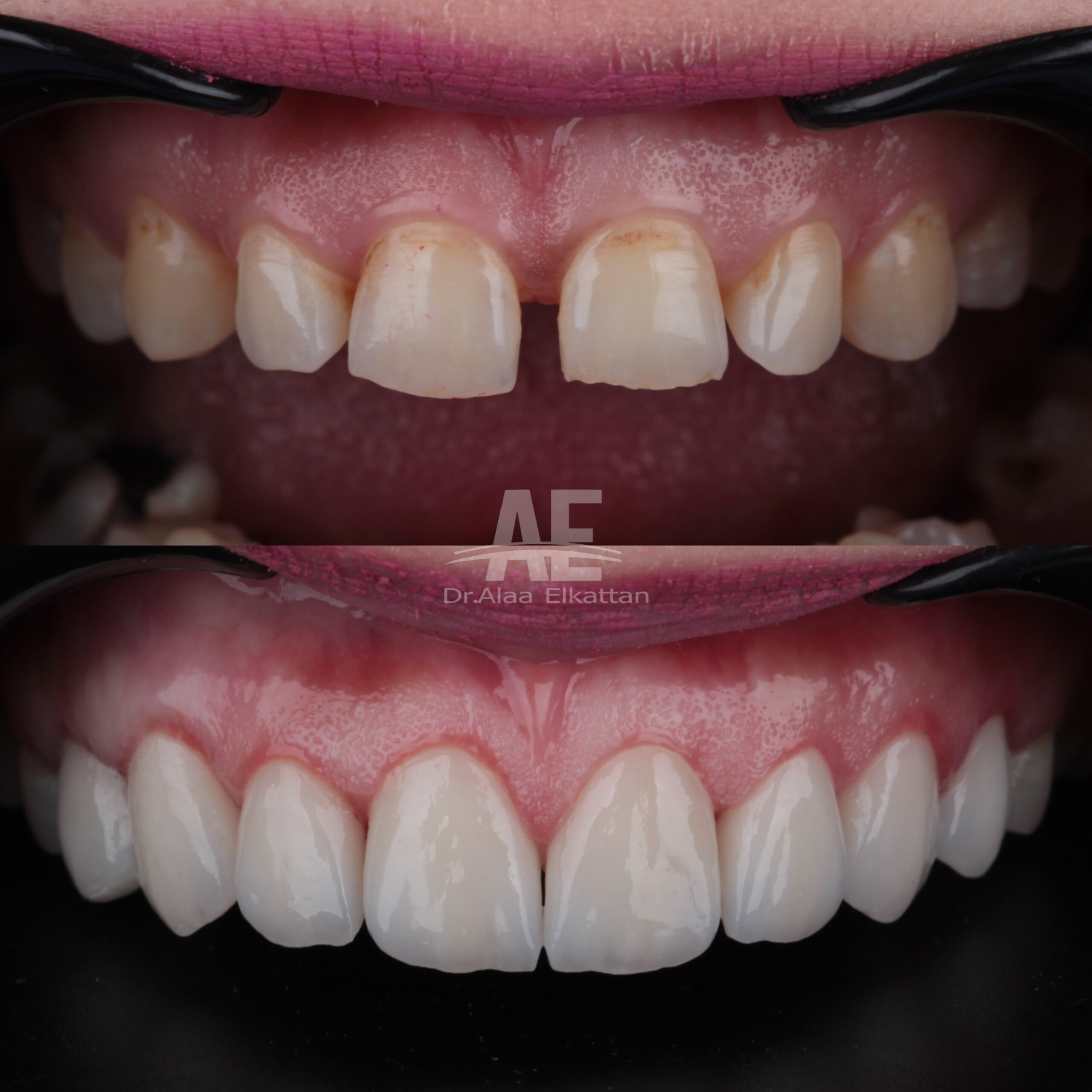 حالة موثقة 31 - Royal Dental Center