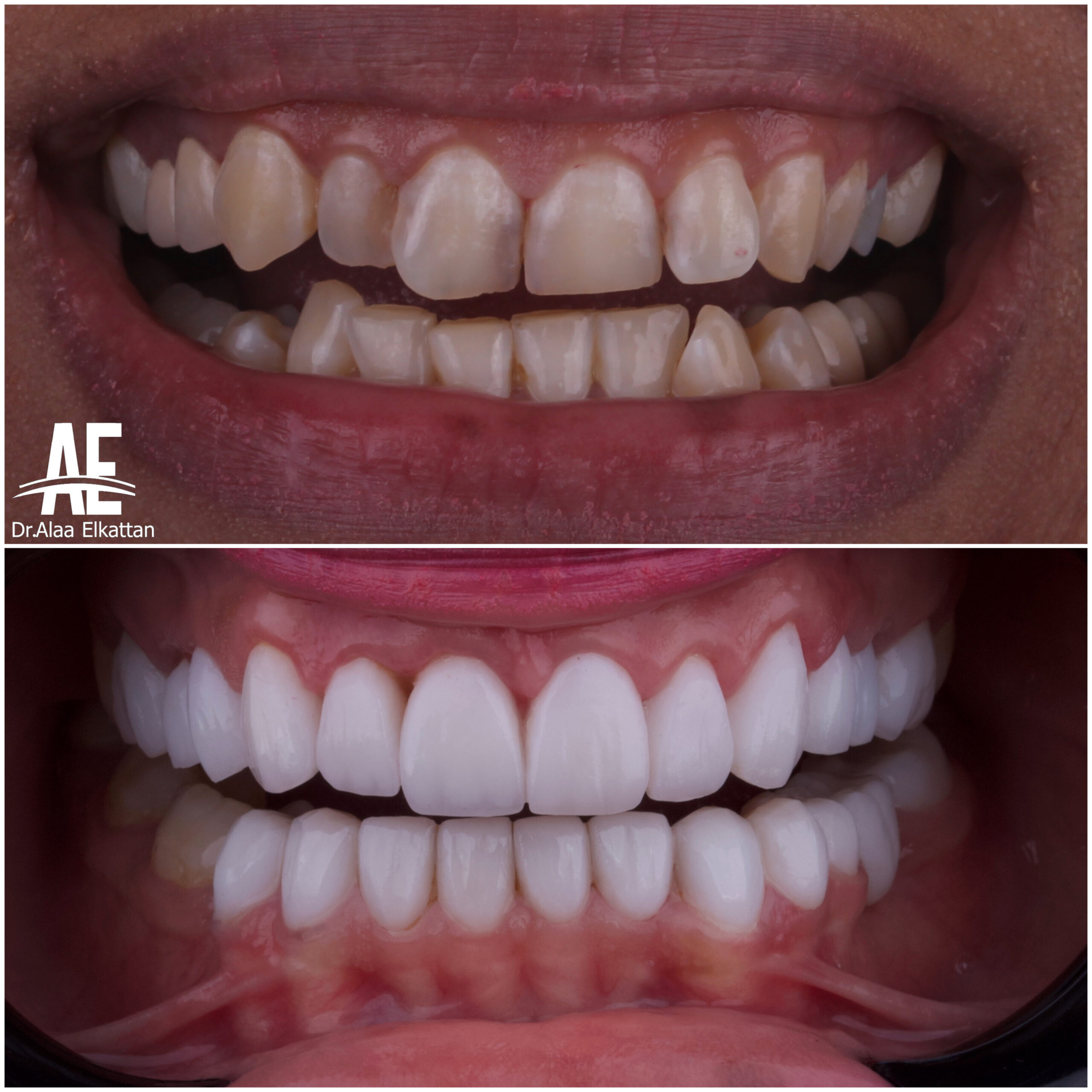 حالة موثقة 46 - Royal Dental Center