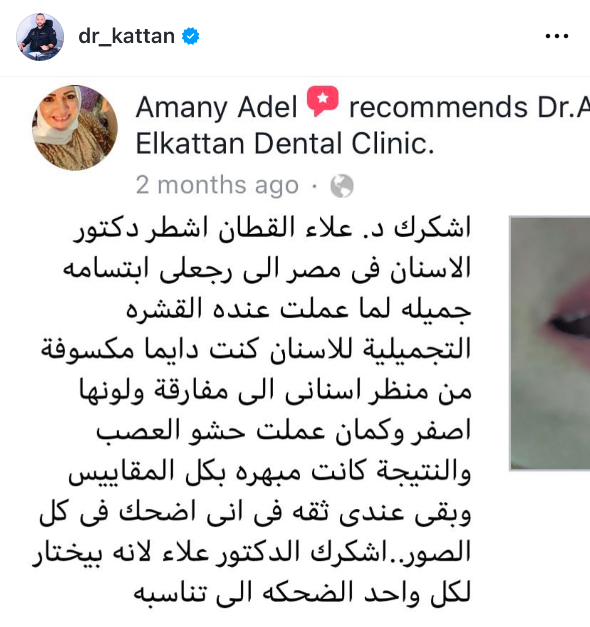 تقييم عميل 87