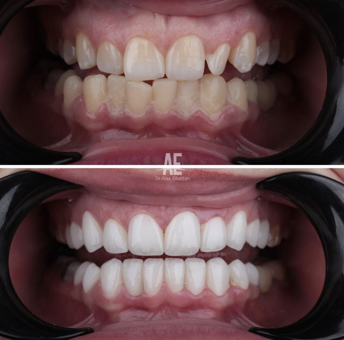 حالة موثقة 73 - Royal Dental Center