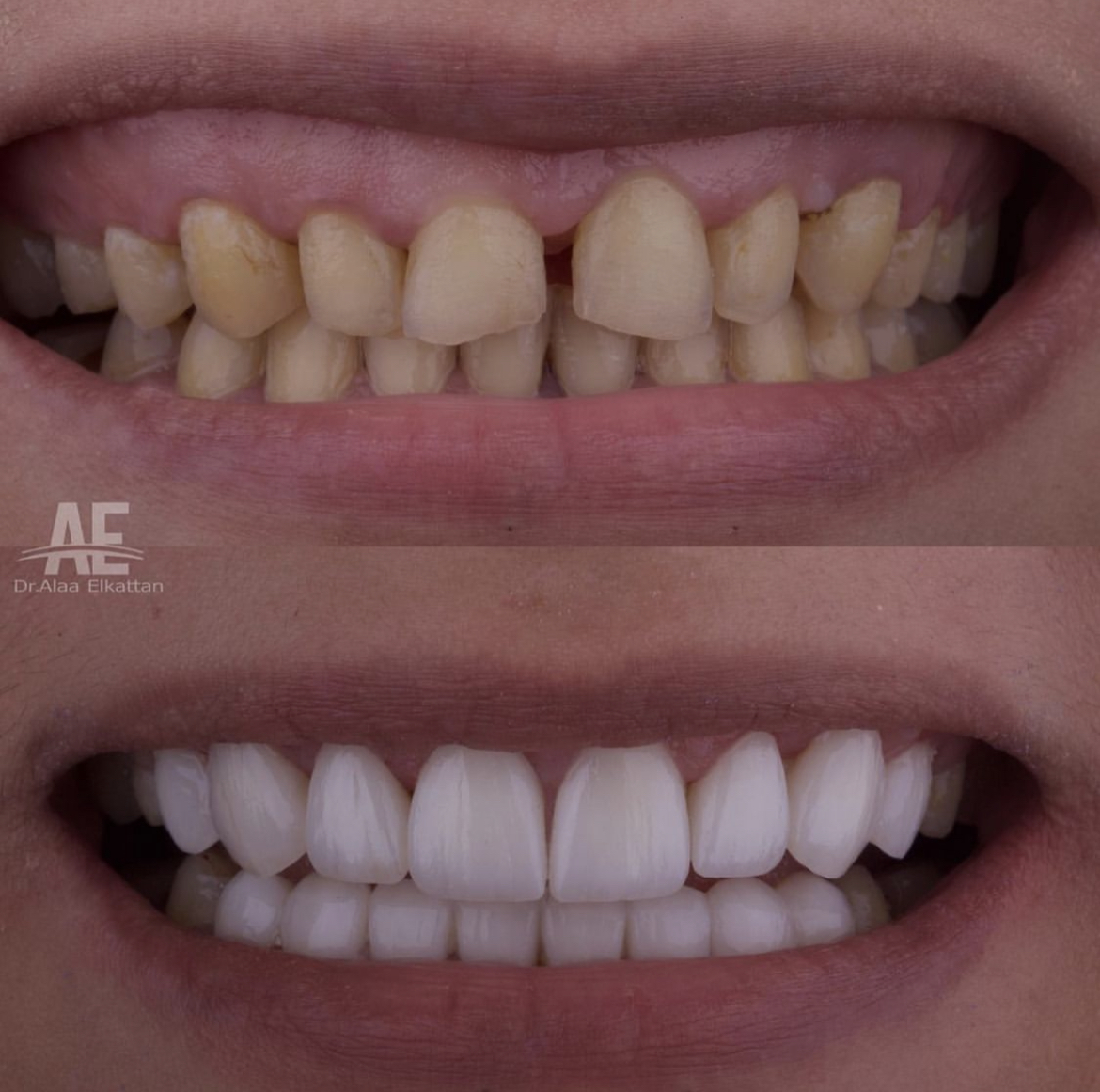 حالة موثقة 72 - Royal Dental Center