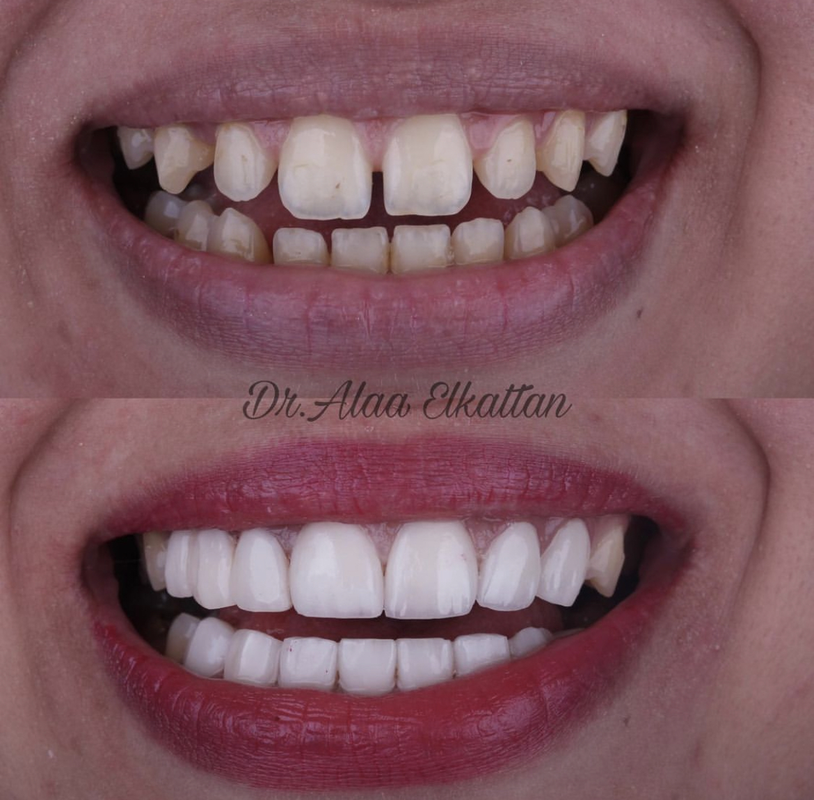 حالة موثقة 76 - Royal Dental Center
